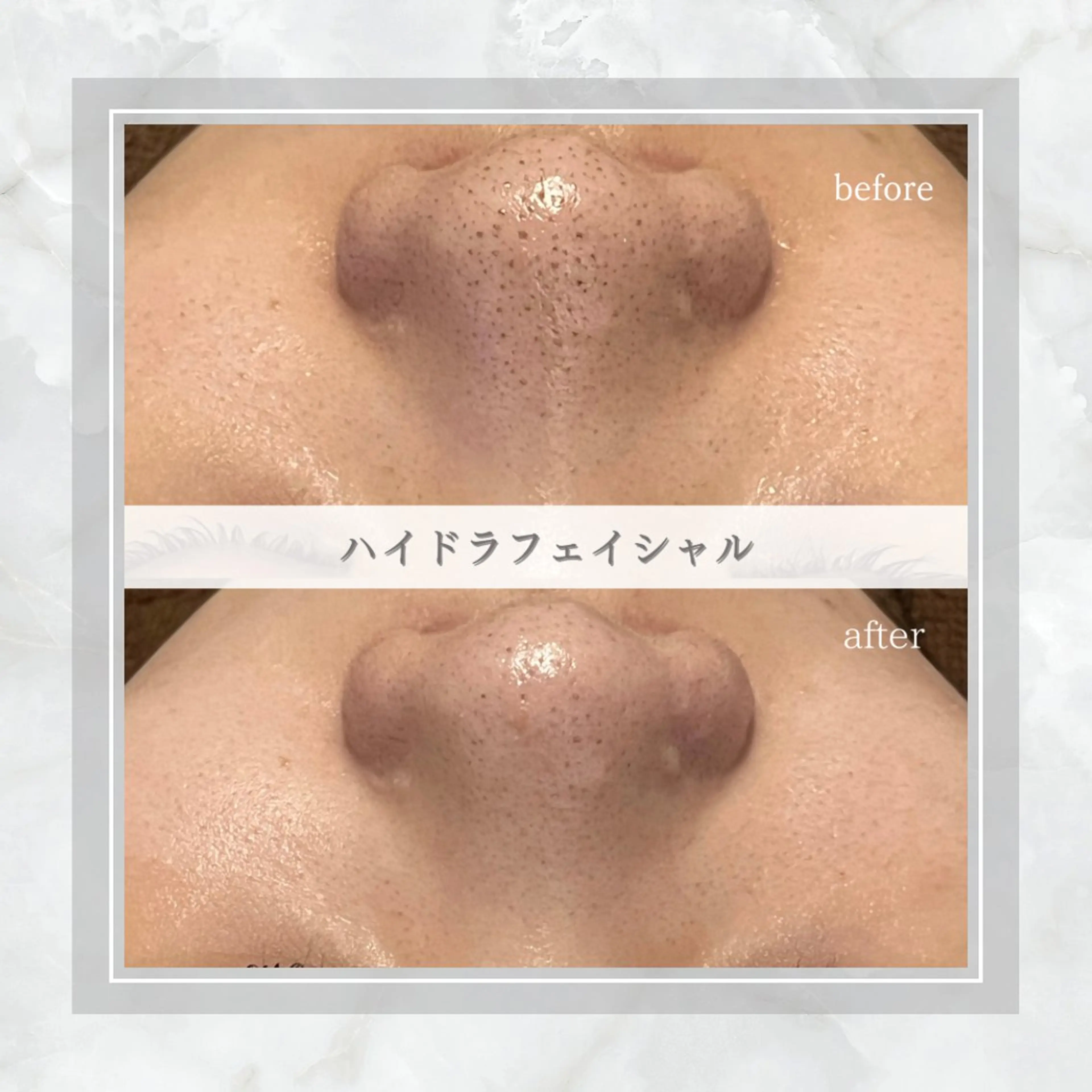 ENCHANT Kaede/肌質改善のその他イメージ