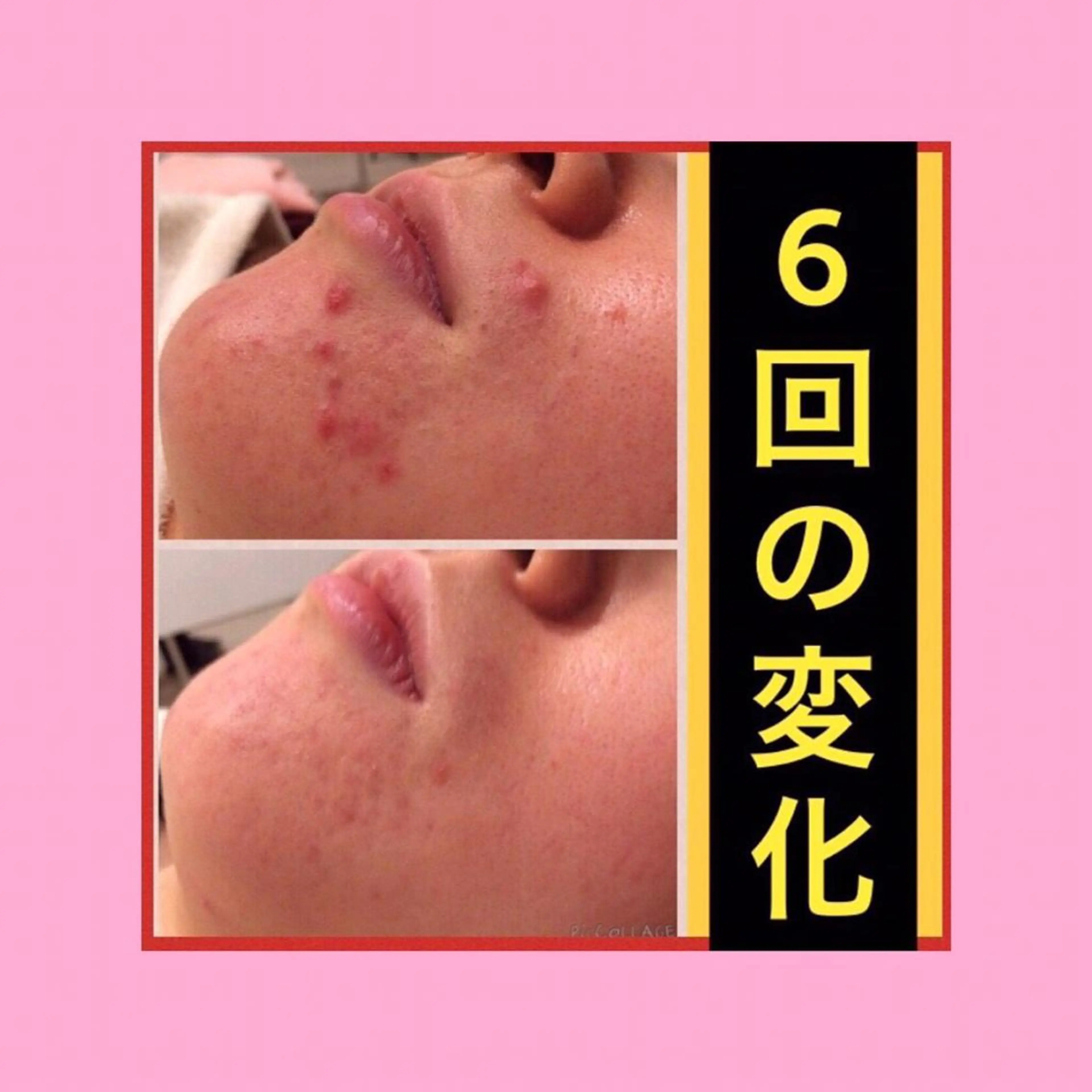 ミディアム カラー パーマ ヘアアレンジ メンズ キッズ ネイル マツエク・マツパ ニキビ・肌質改善専門 ♡人生が変わるサロンのエステ・リラクイメージ