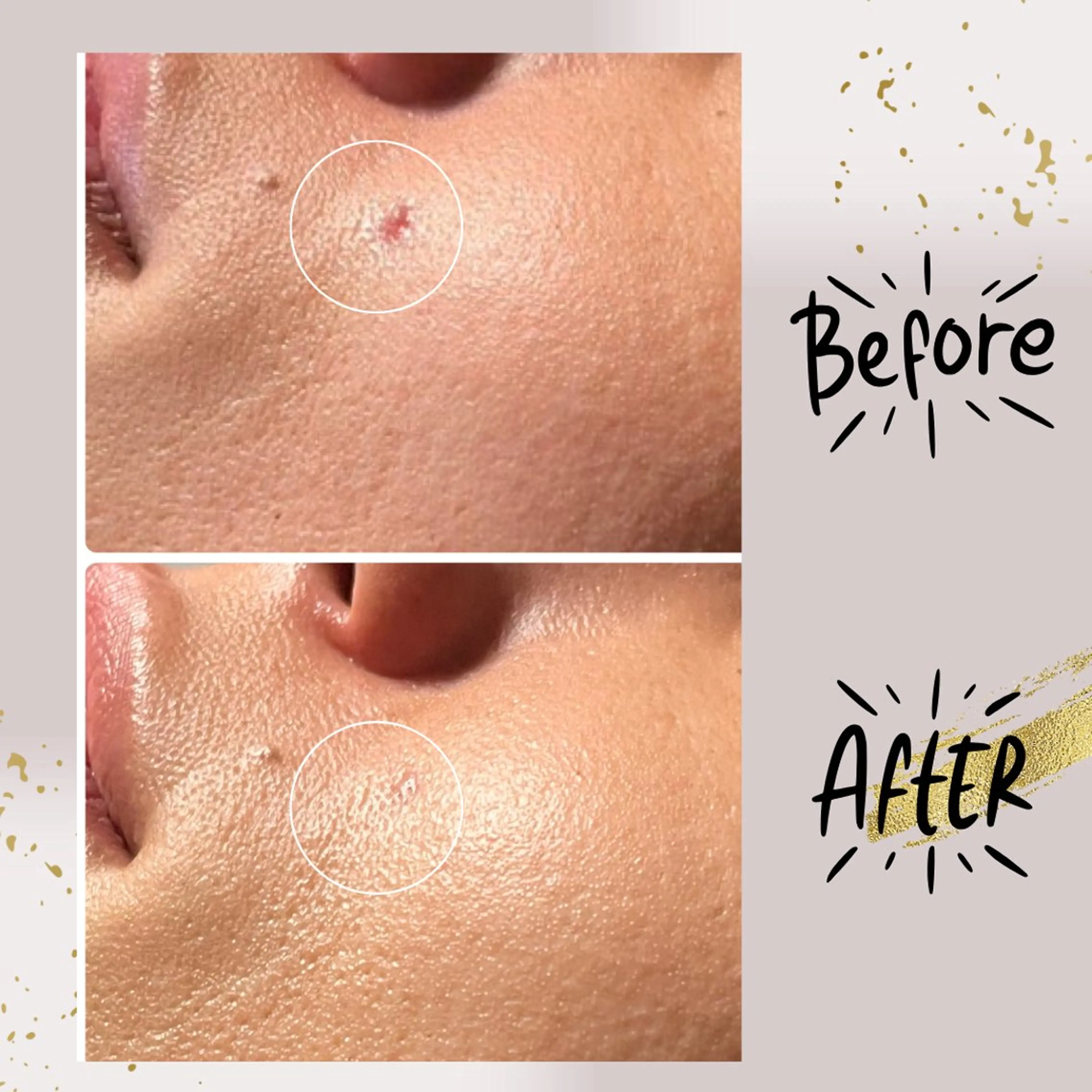 エステ リラク ピーリング専門店 Belluteのエステ・リラクイメージ