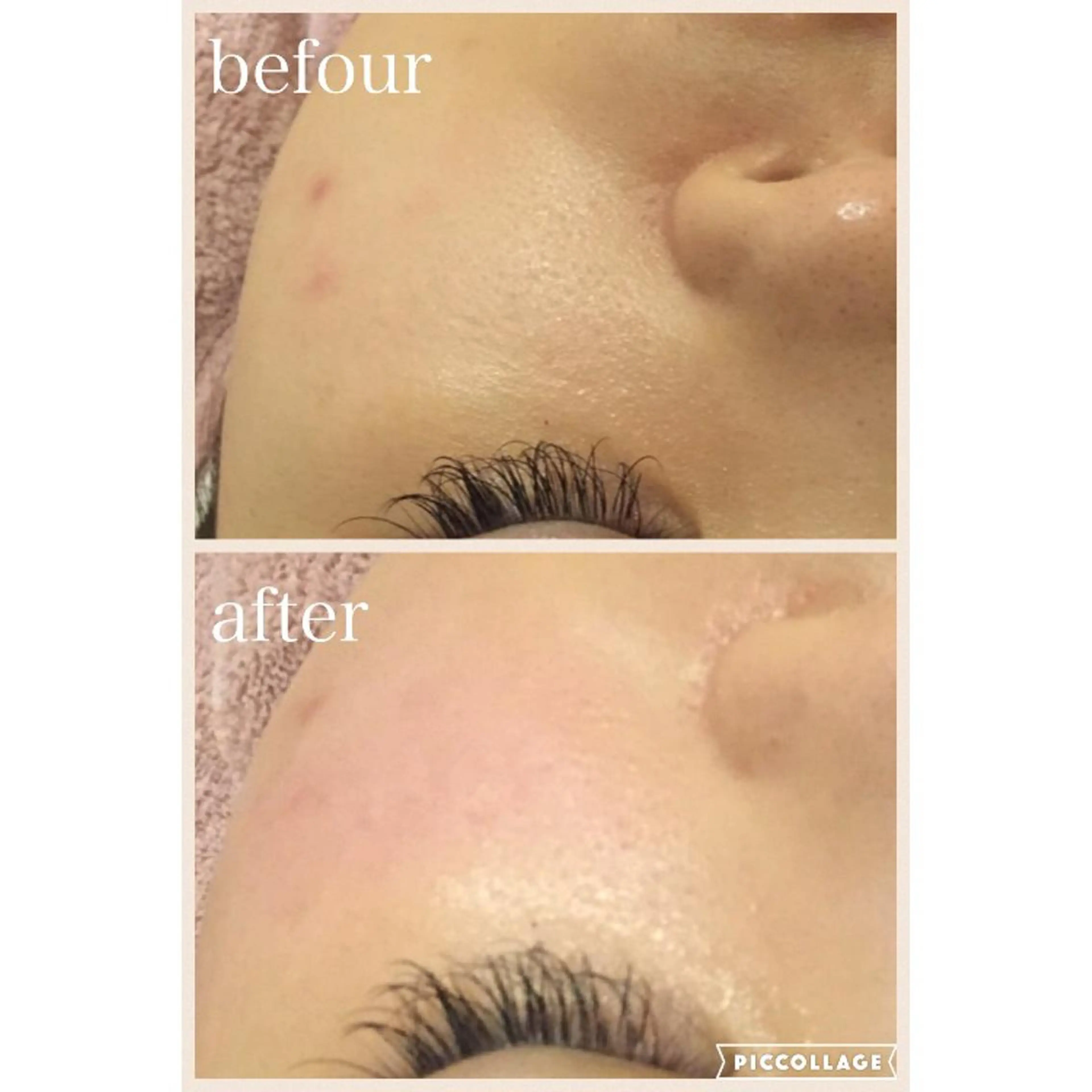 ニキビ跡専門サロン Ａｉｎａのエステ・リラクイメージ