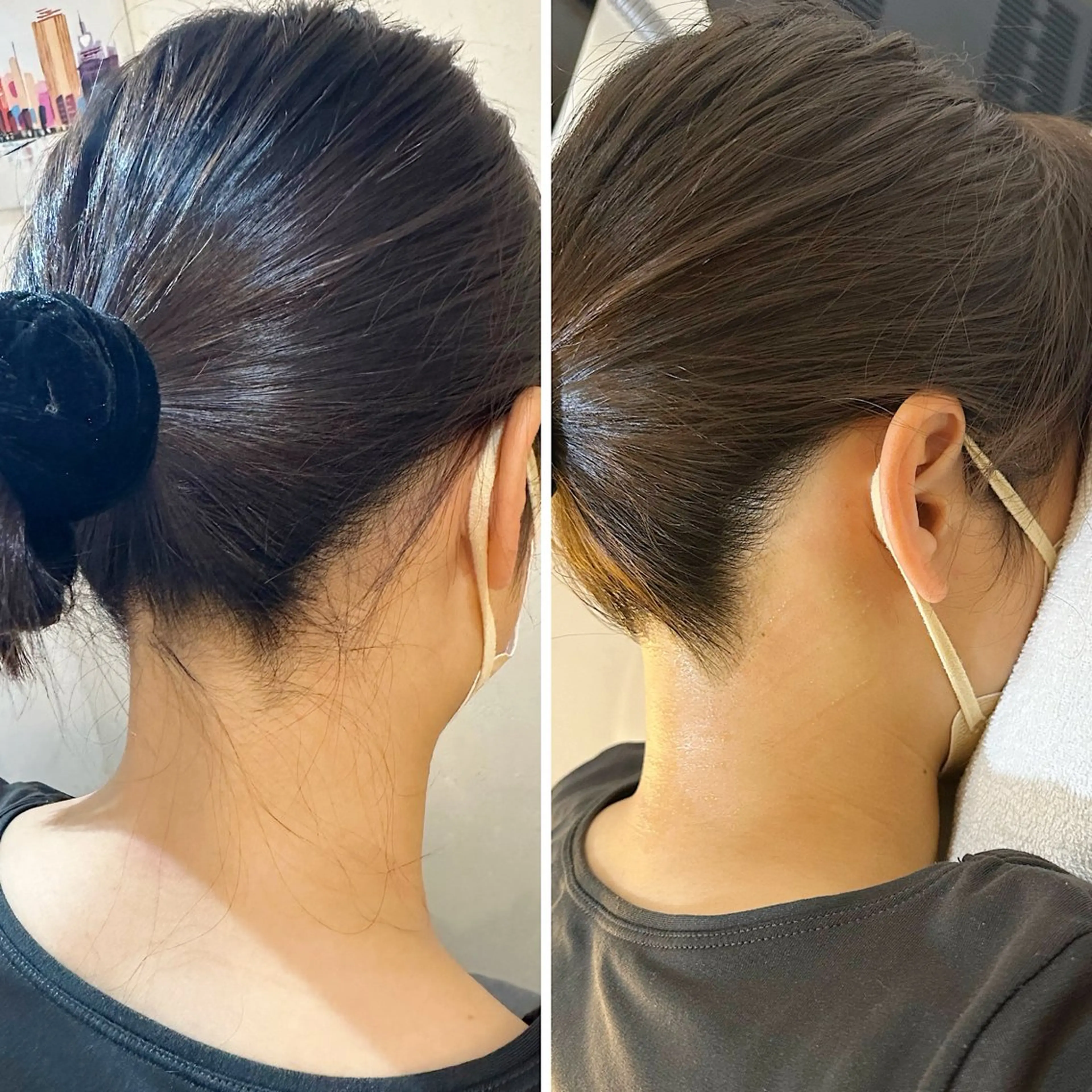 脱毛 うなじ脱毛/美肌脱毛 LABELのエステ・リラクイメージ