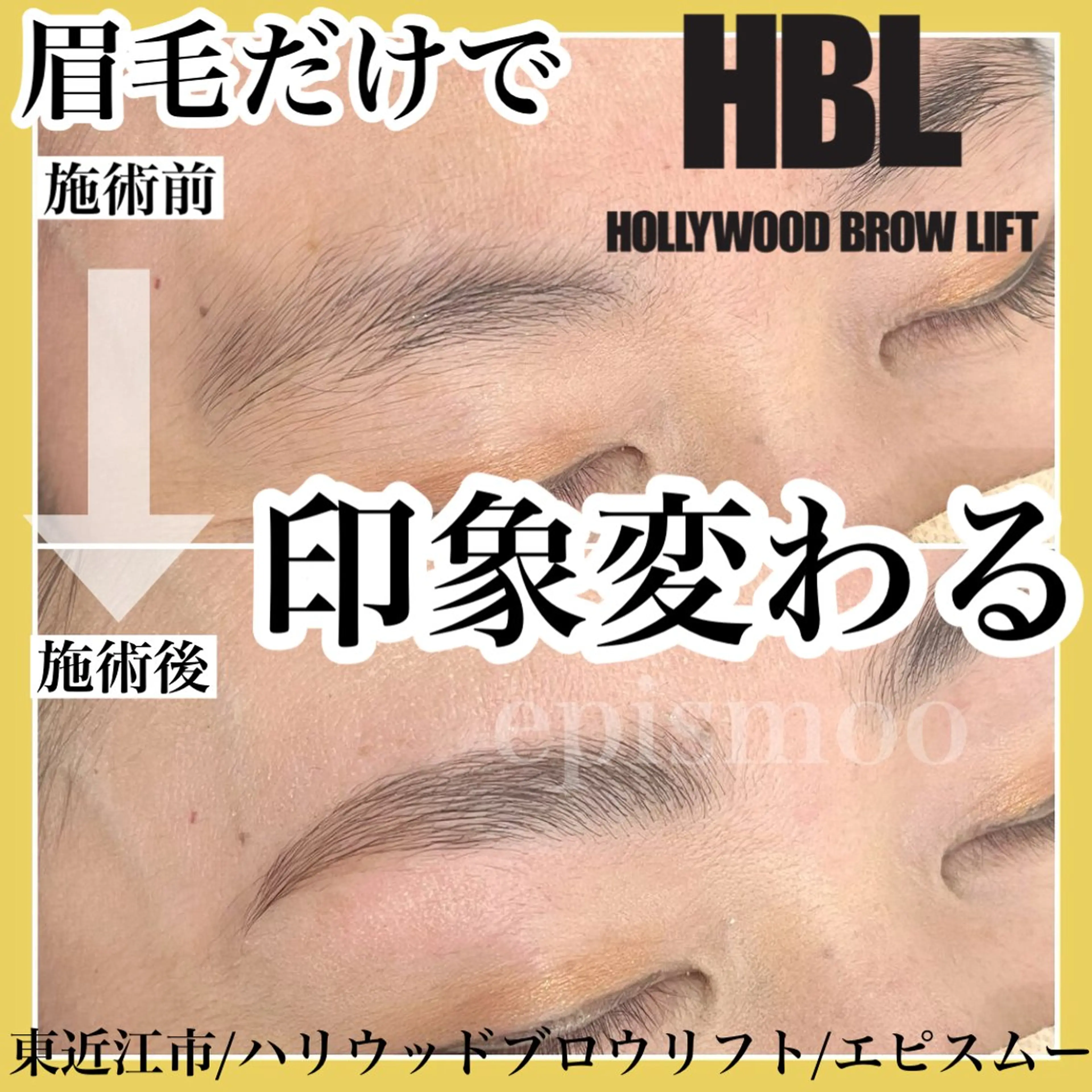 アイブロウ その他(アイブロウ) epismoo 脱毛/HBL/毛穴の眉毛・アイブロウイメージ