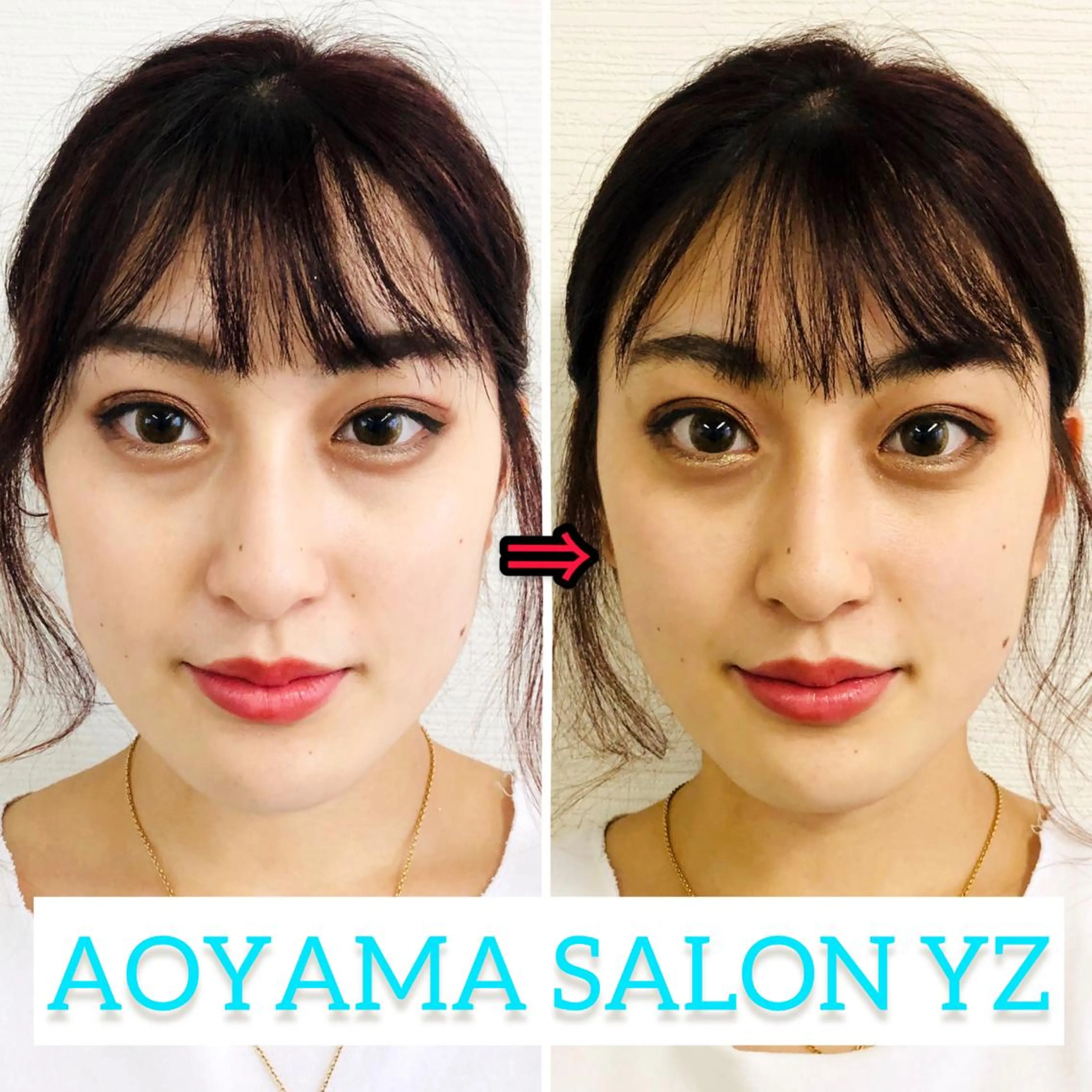 渋谷 小顔美容鍼 専門サロン YZのエステ・リラクイメージ
