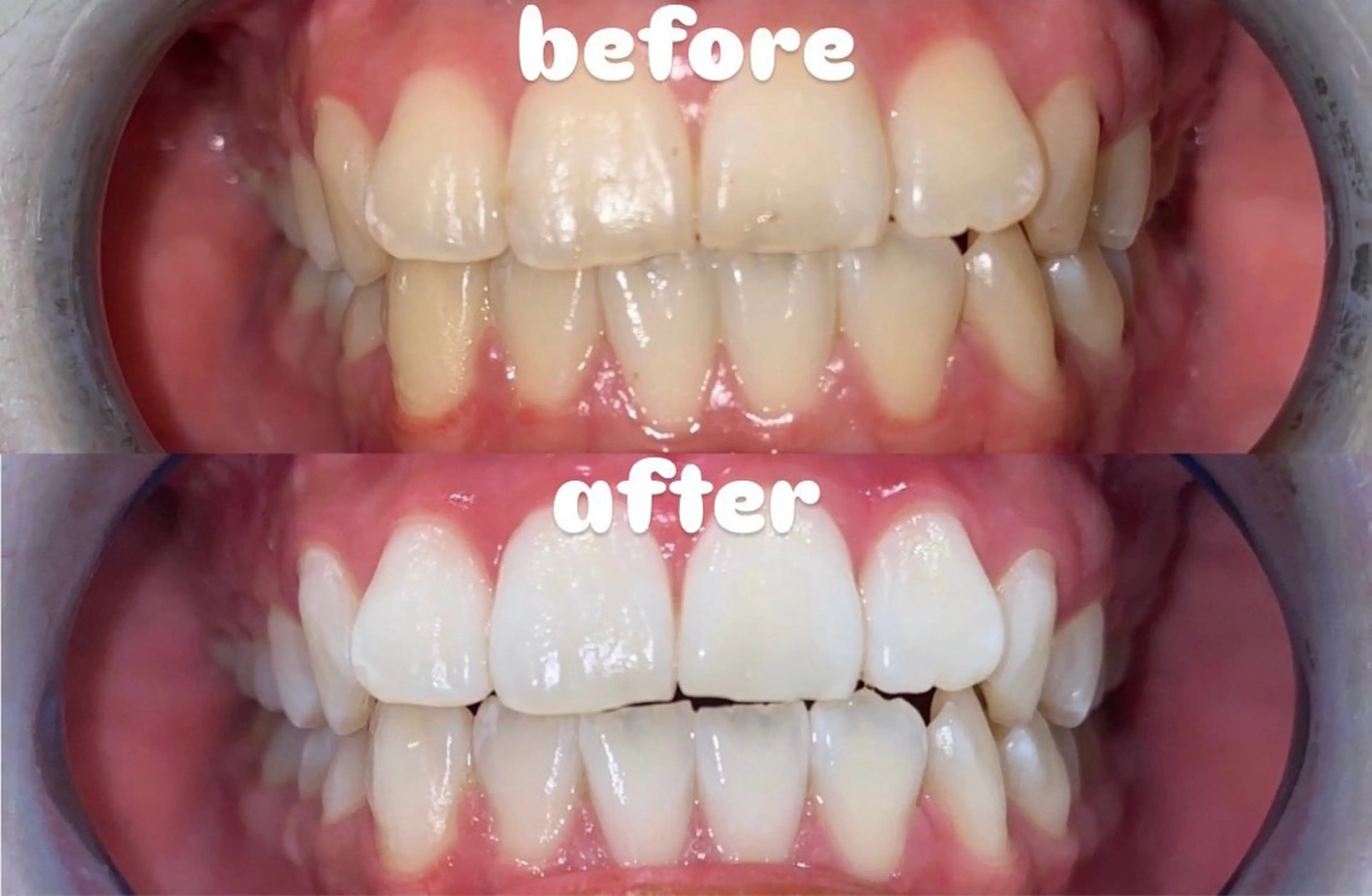 ホワイトニング ビューティー光の森店のエステ・リラクイメージ