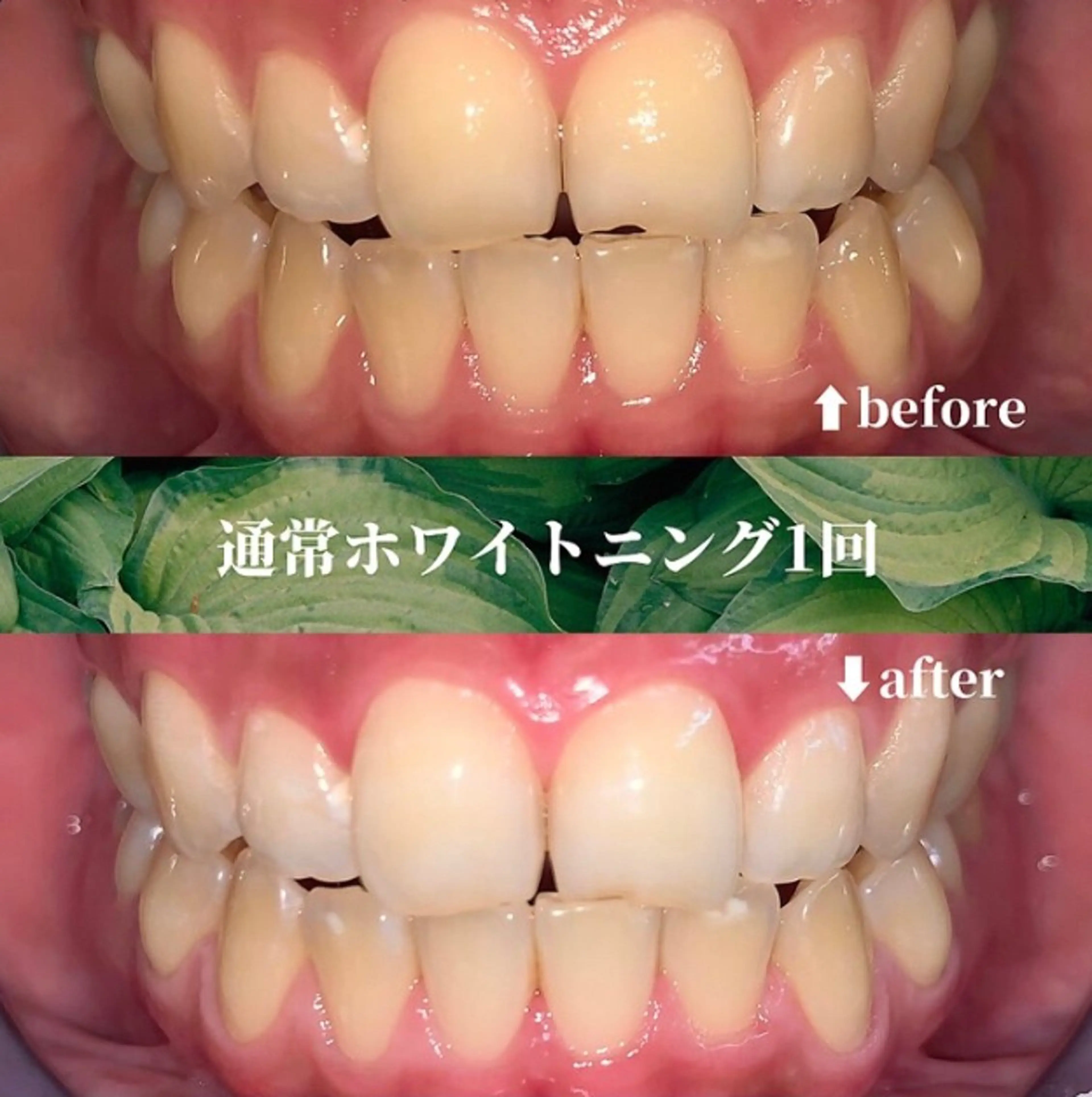 futaba ホワイトニング/天神のエステ・リラクイメージ