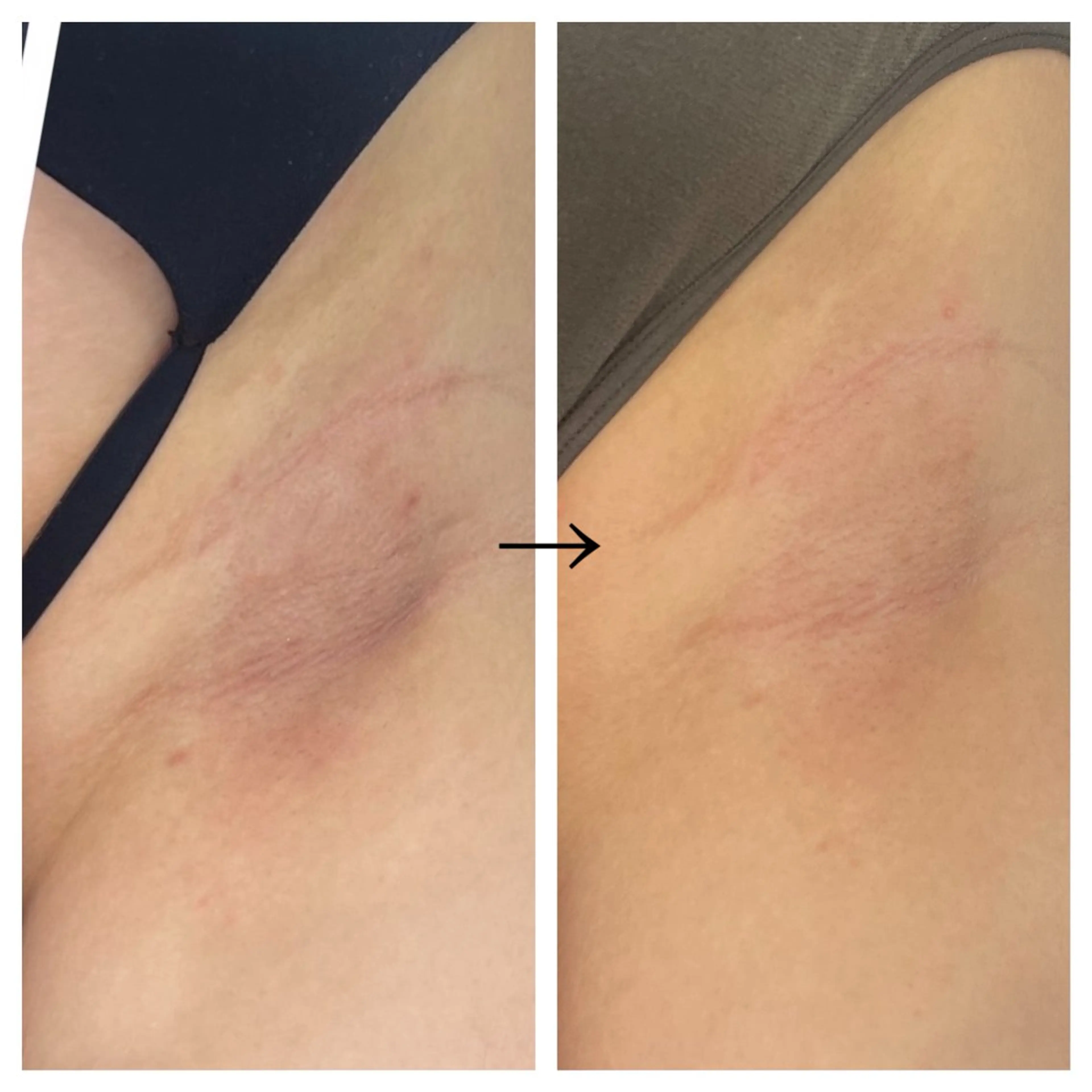 脱毛 ビューティー ミロワールのエステ・リラクイメージ