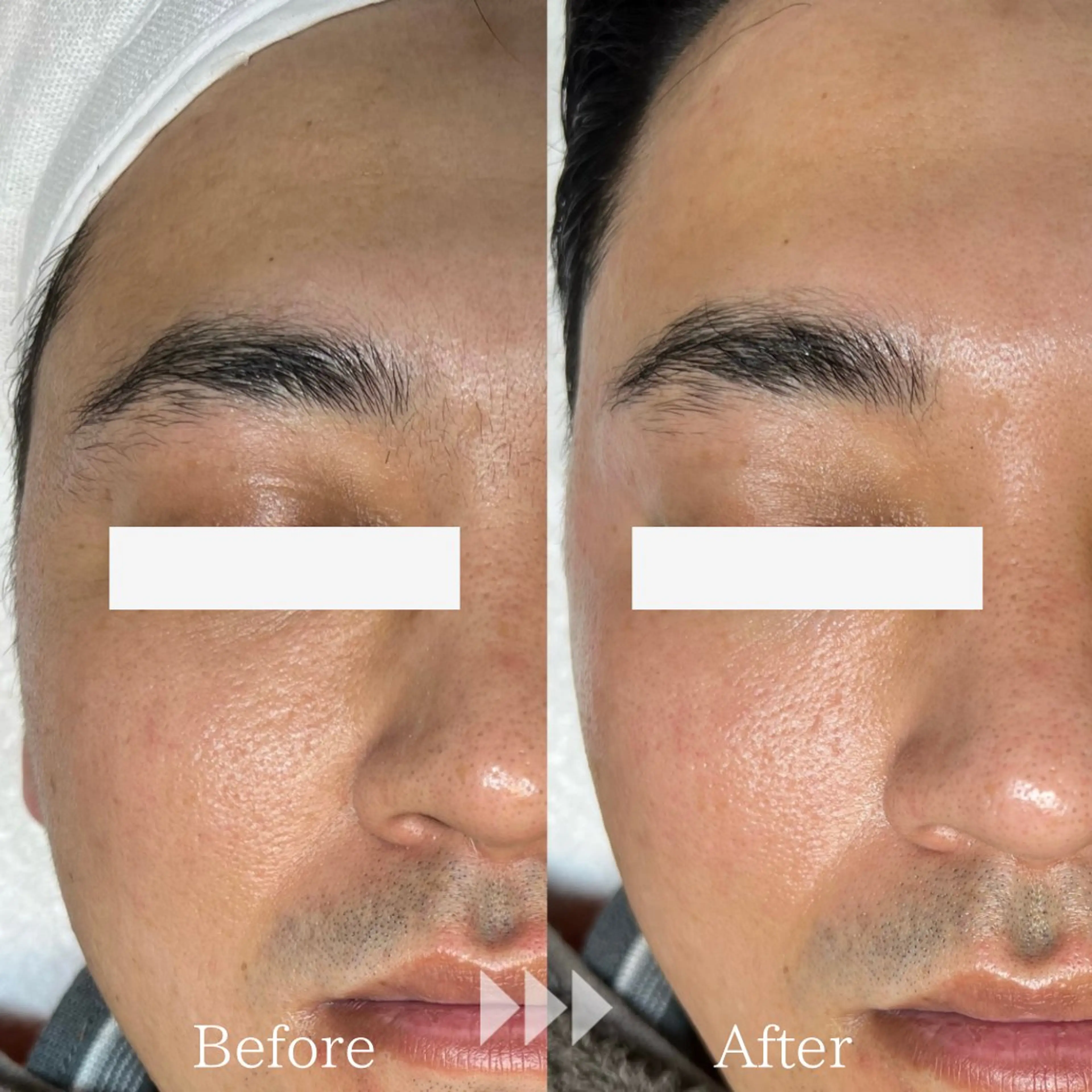 脱毛 WHITE WAX柏店所属・brilliant .のエステ・リラクイメージ