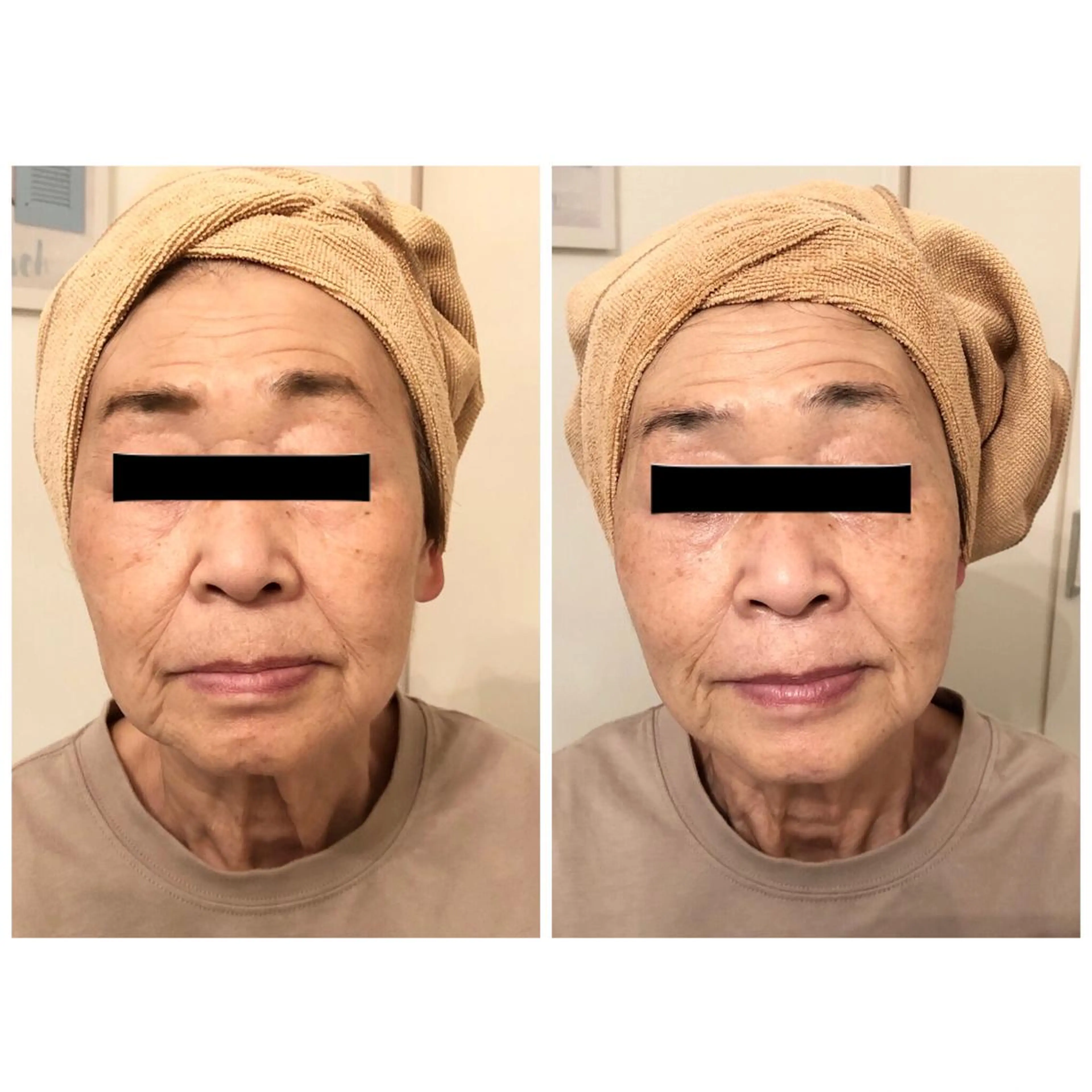 エステ リラク おうちサロン B-ROOMのエステ・リラクイメージ