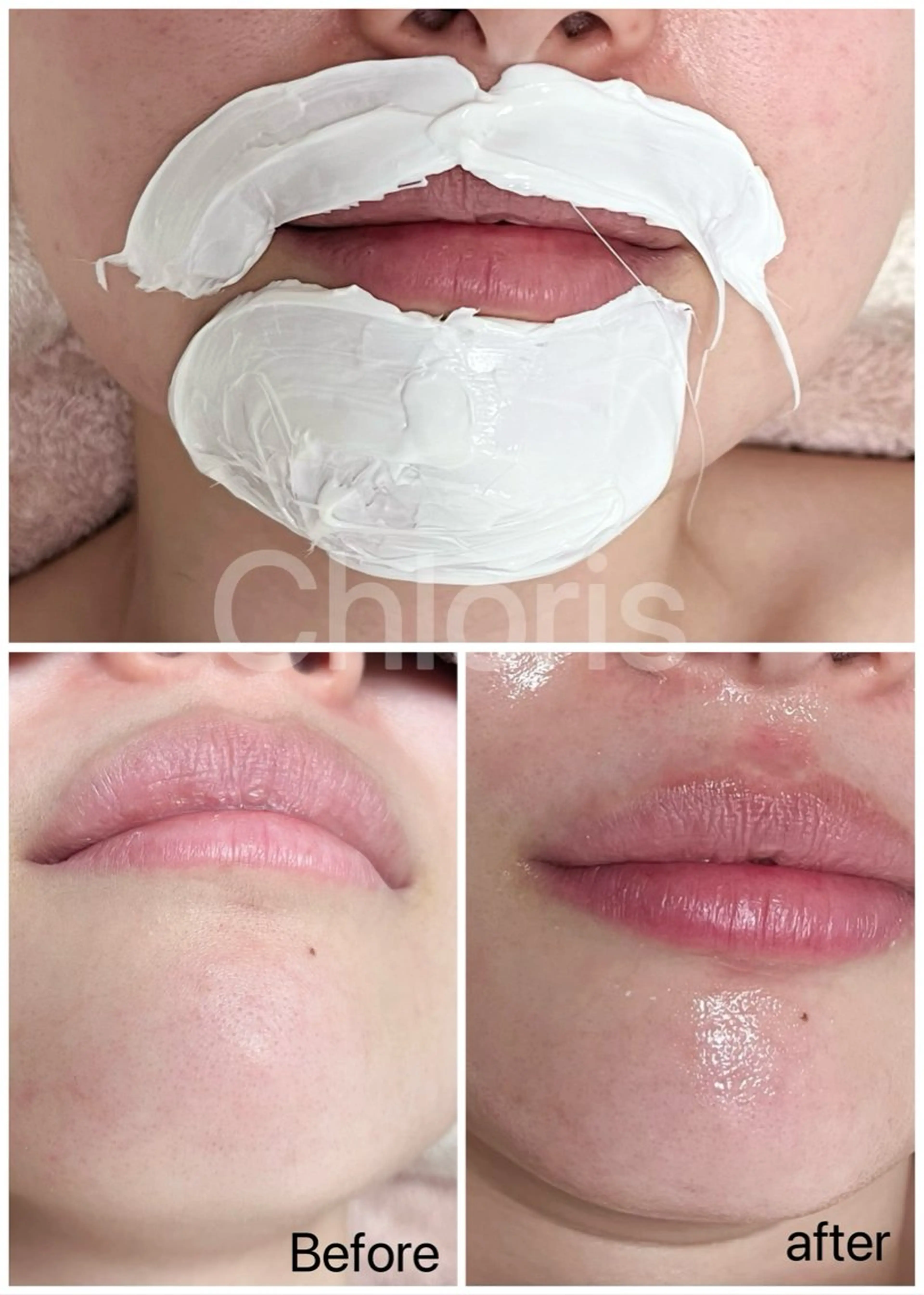 川越デリケートゾーン 光脱毛/ワックス脱毛のエステ・リラクイメージ