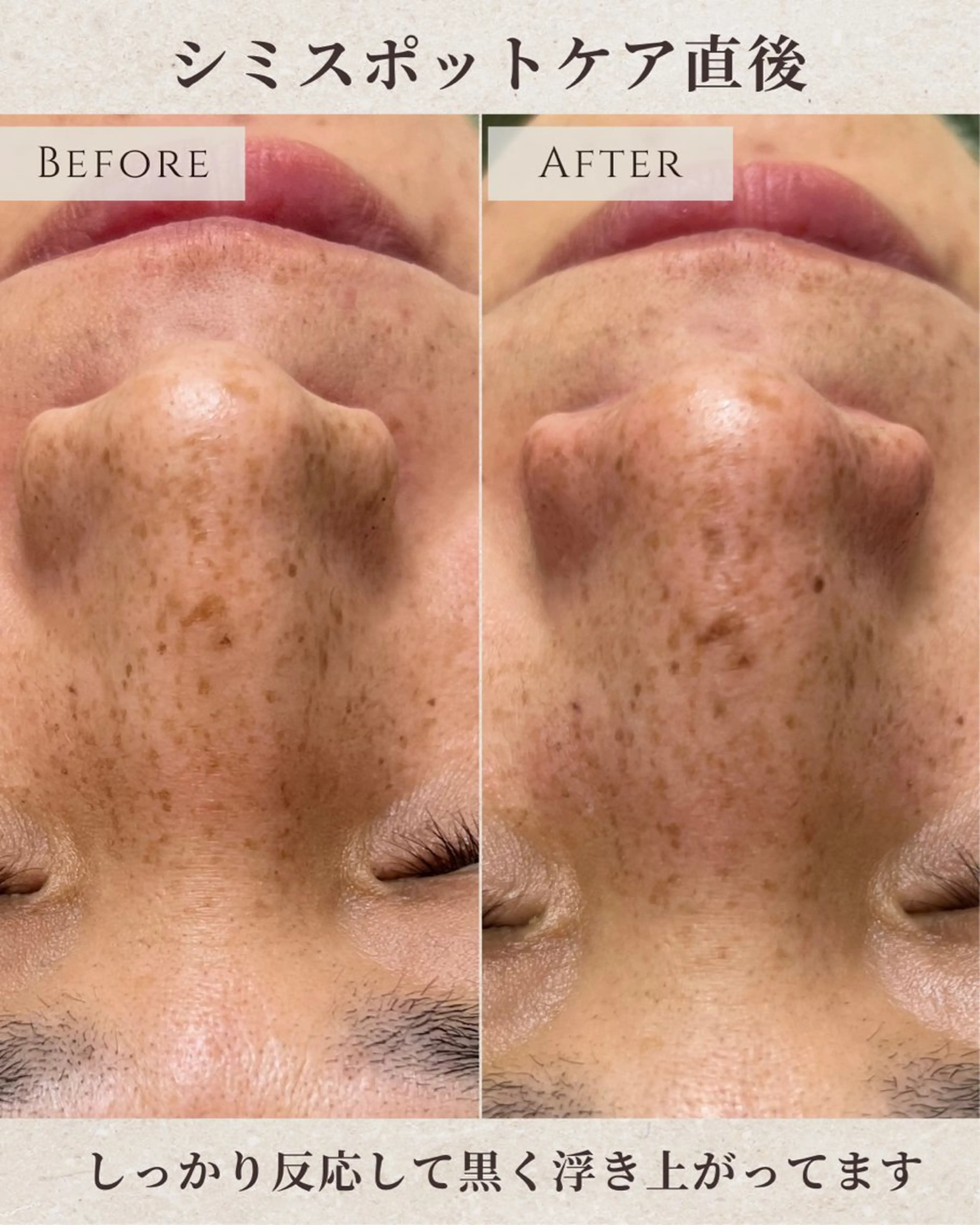 稲垣 優のエステ・リラクイメージ