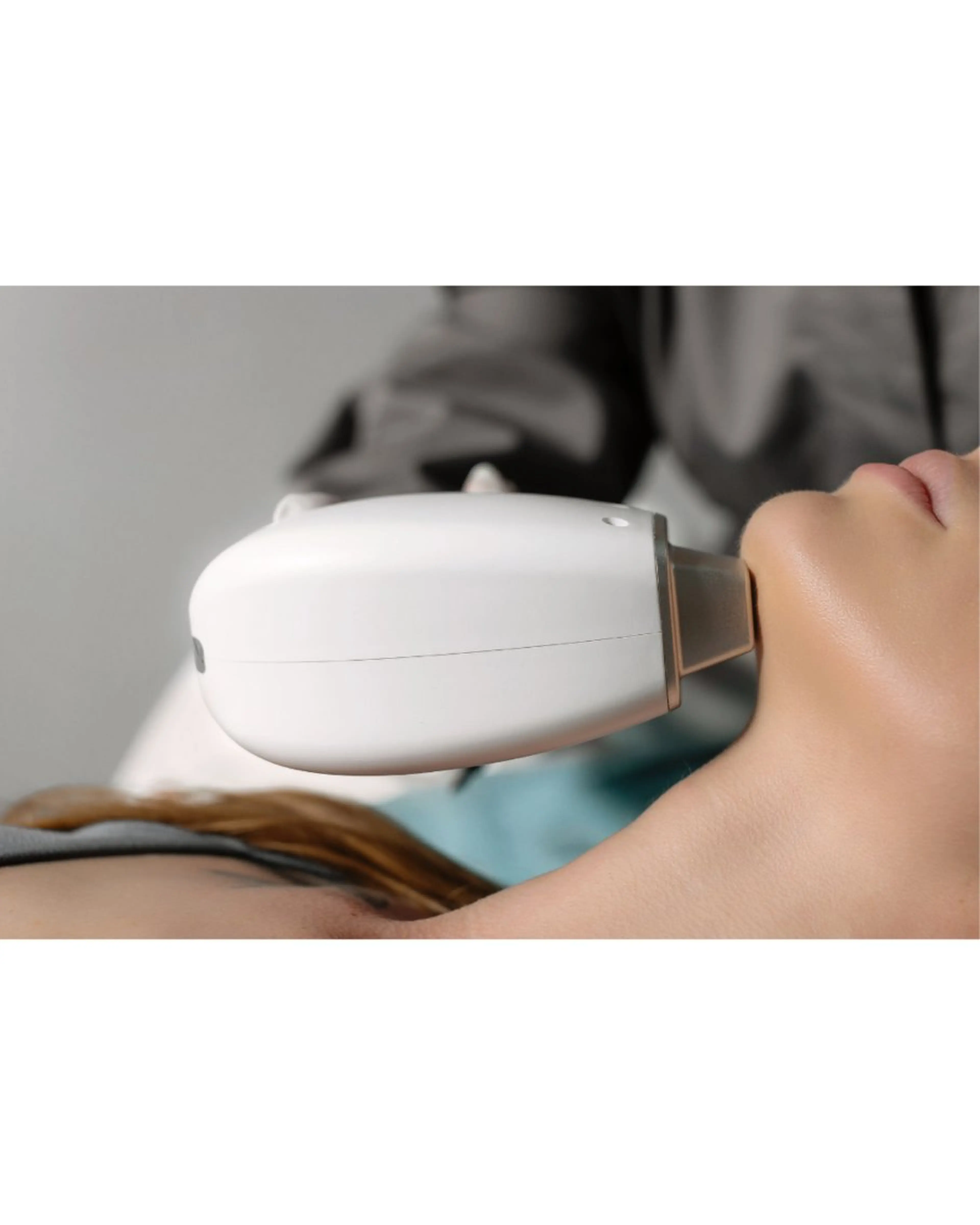 【メンズ】青ヒゲ解消！ヒゲ脱毛の写真