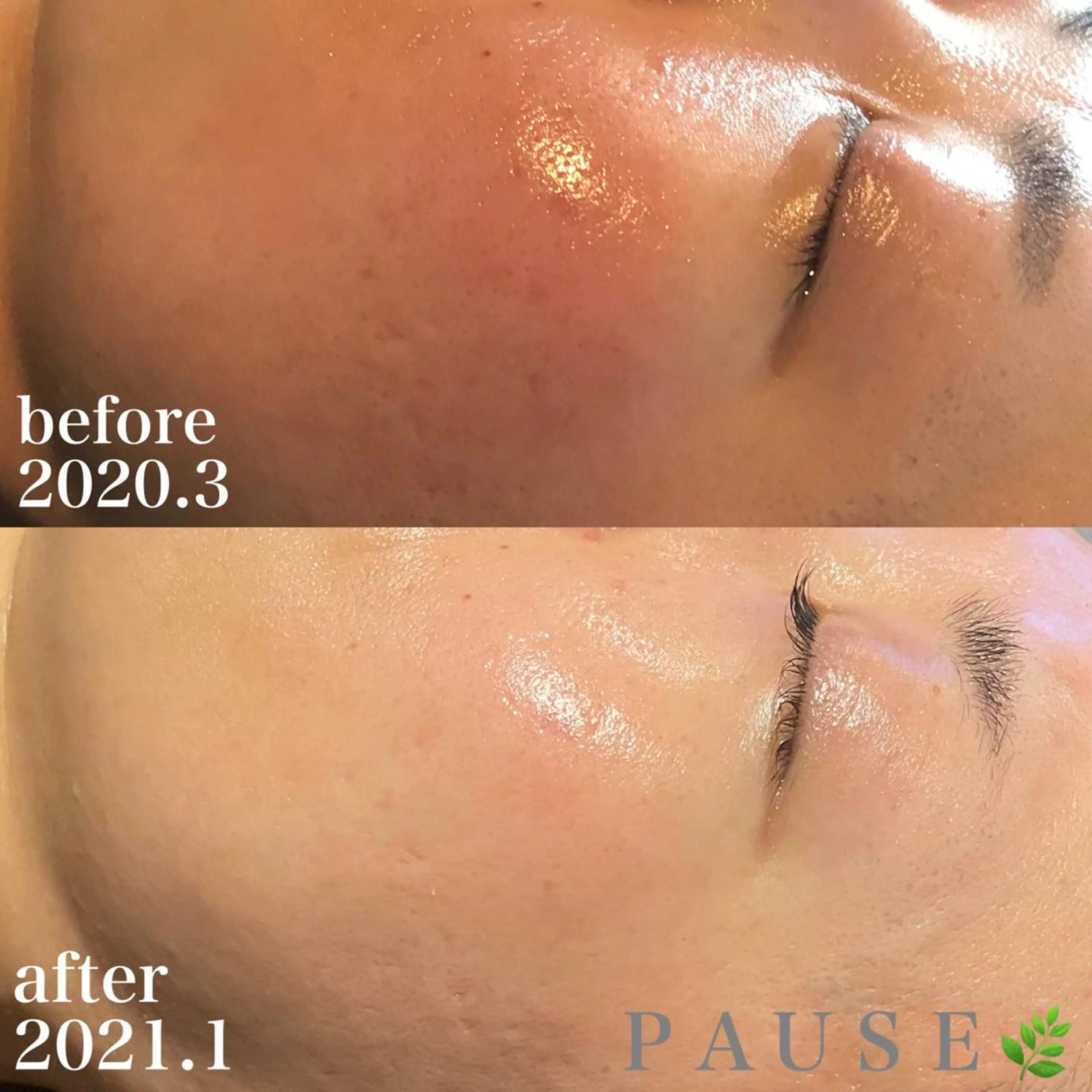 エステ 浜野 恵美のエステ・リラクイメージ