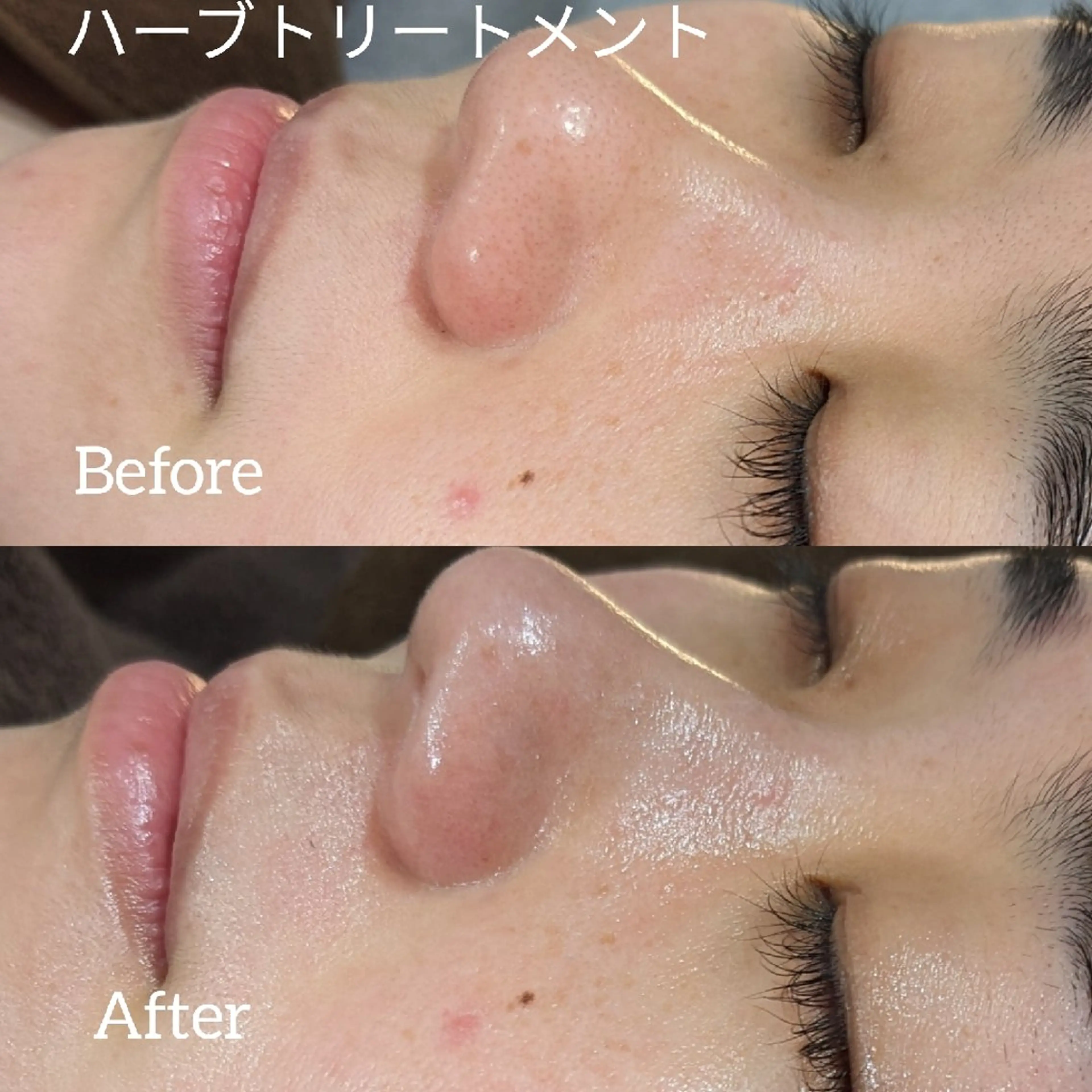 ﾌｪｲｼｬﾙｴｽﾃ ﾗﾄｩｰﾙ伊深のエステ・リラクイメージ