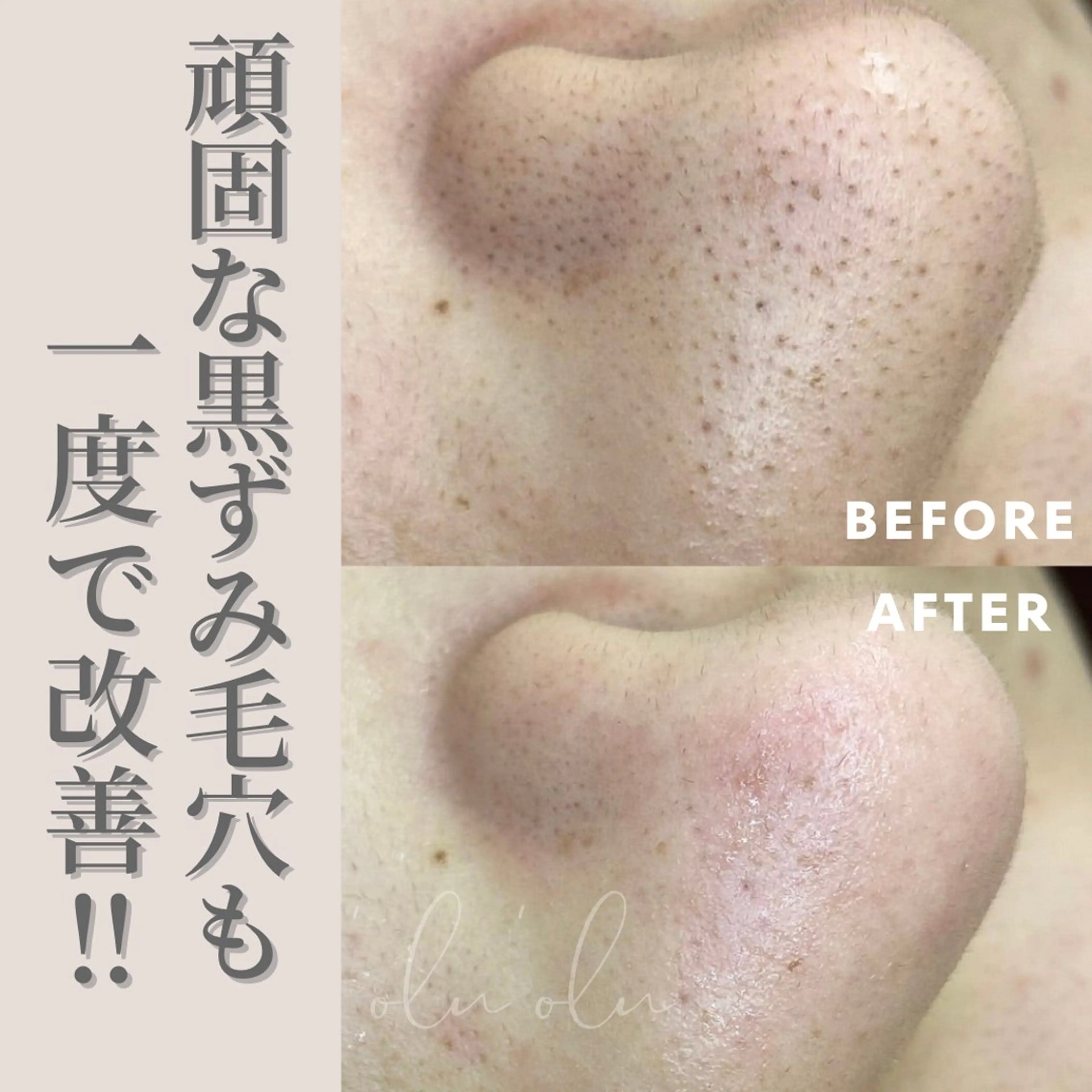 〈医療提携/毛穴・シミケア専門店〉 'Olu'Olu【オルオル】所属・'Olu'Olu シミ・毛穴専門サロンのエステ・リラクイメージ