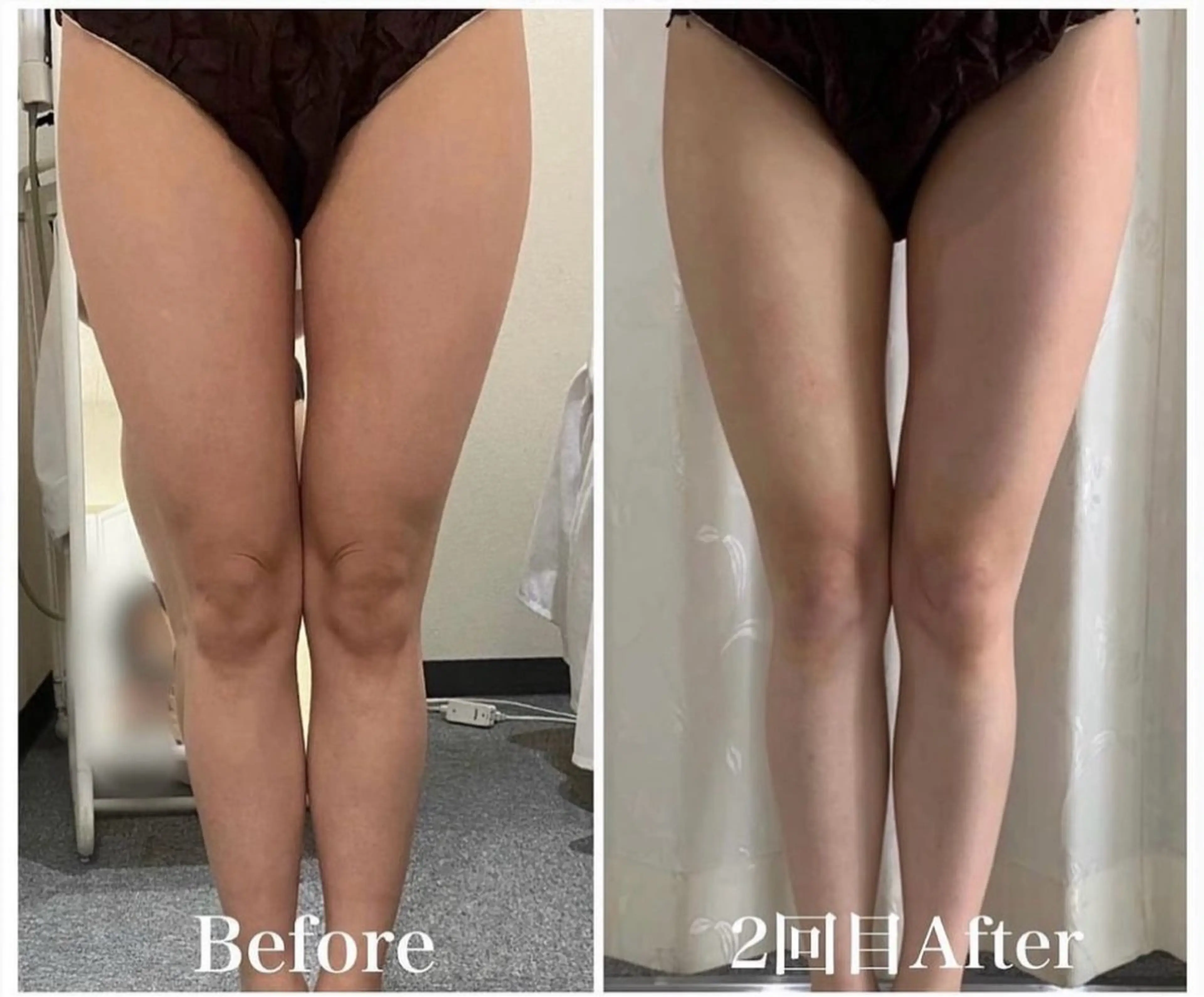 メディカルサロン 小川のエステ・リラクイメージ