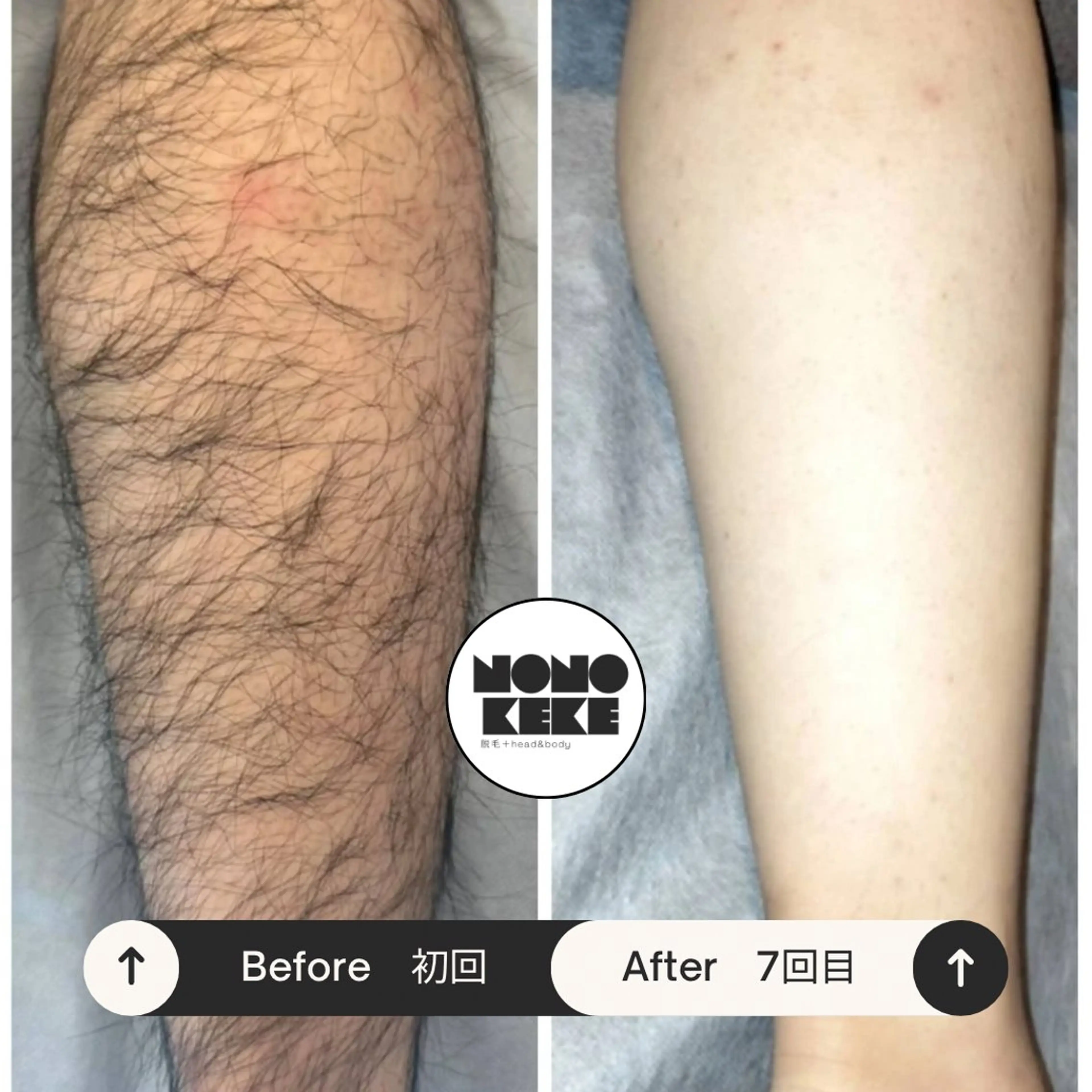 メンズ NONOKEKE ノノケケのエステ・リラクイメージ