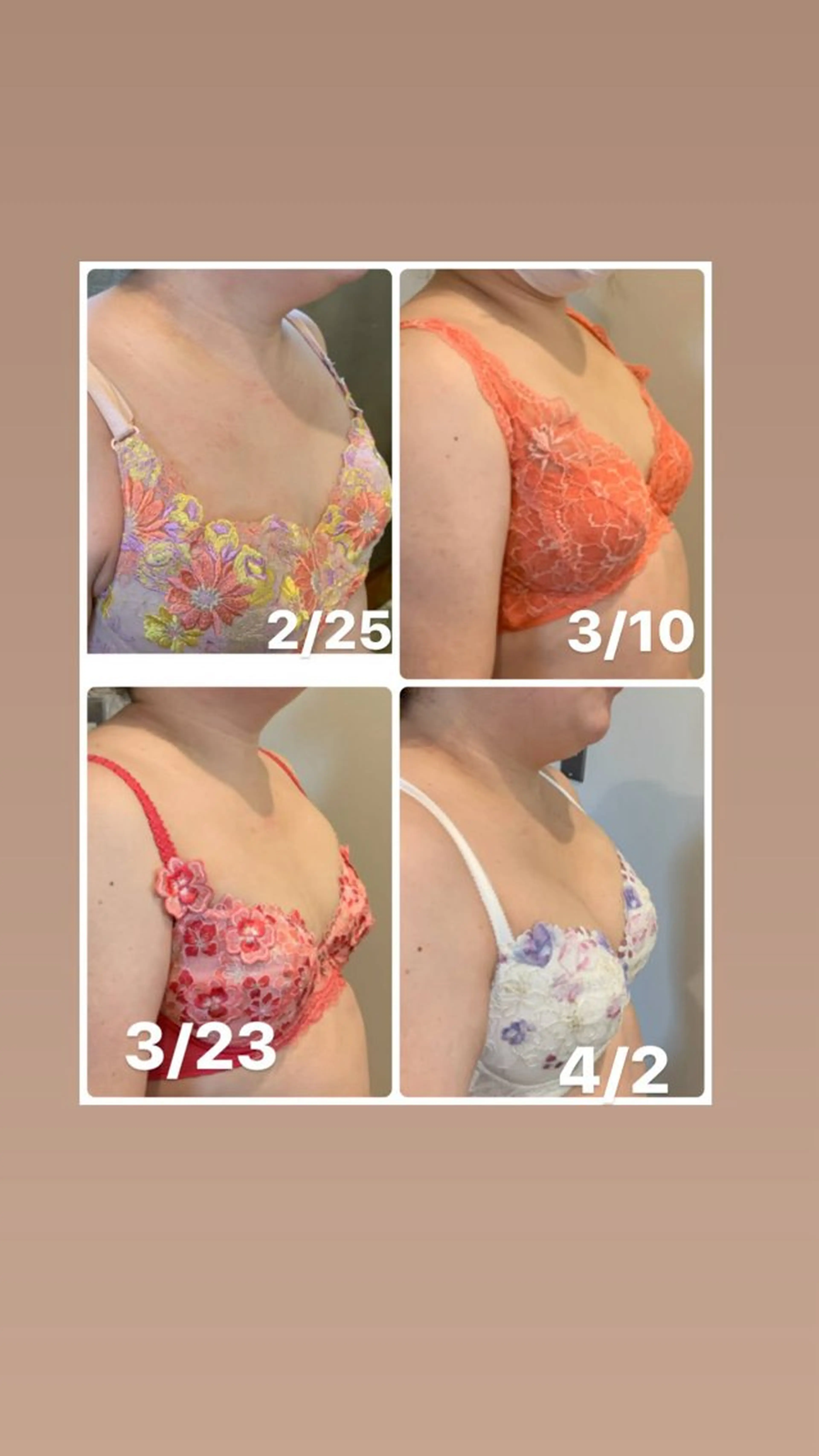 つるんとむき卵肌に 🌟ハーブピーリングのエステ・リラクイメージ