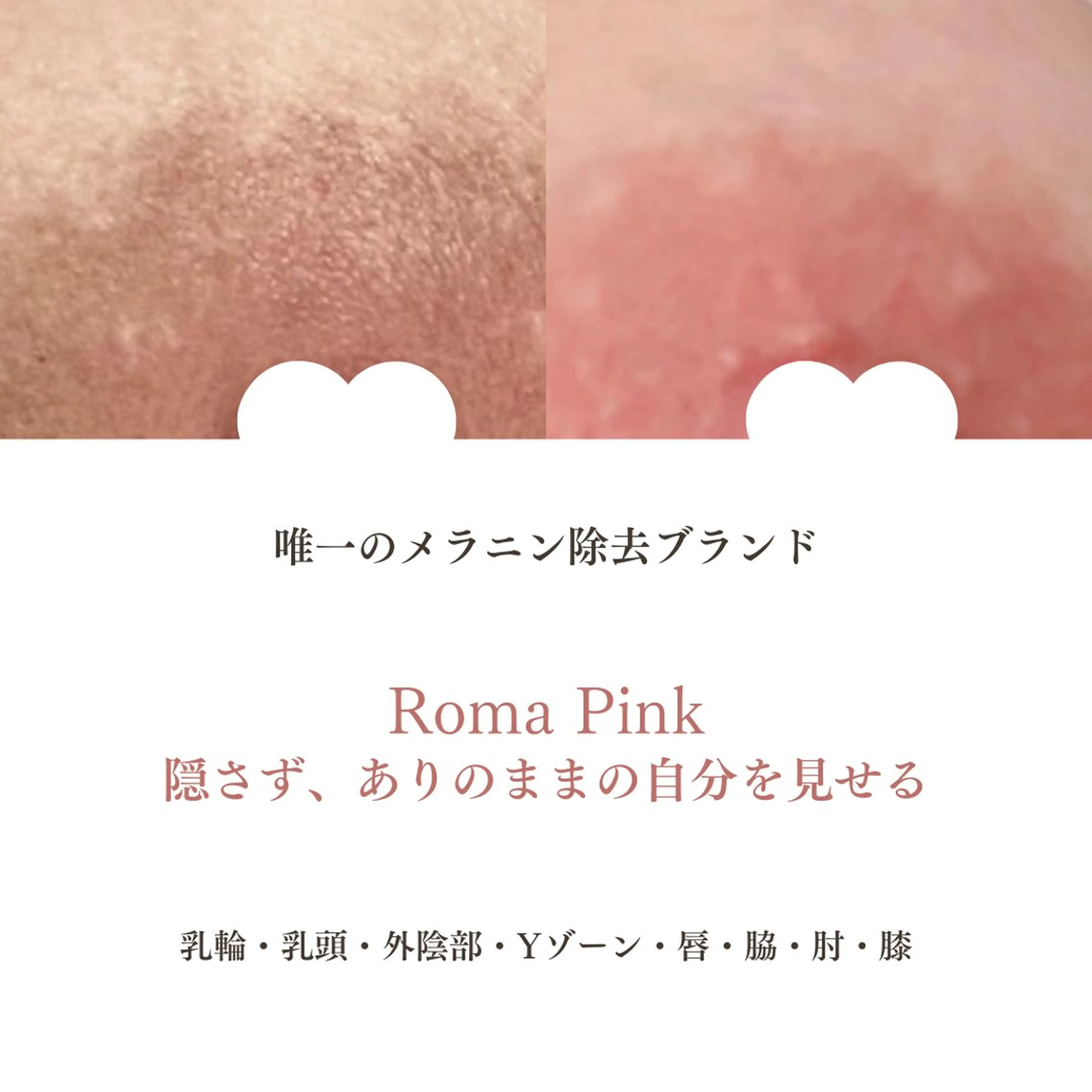 Raviy 【痩身専門・肌管理】のエステ・リラクイメージ