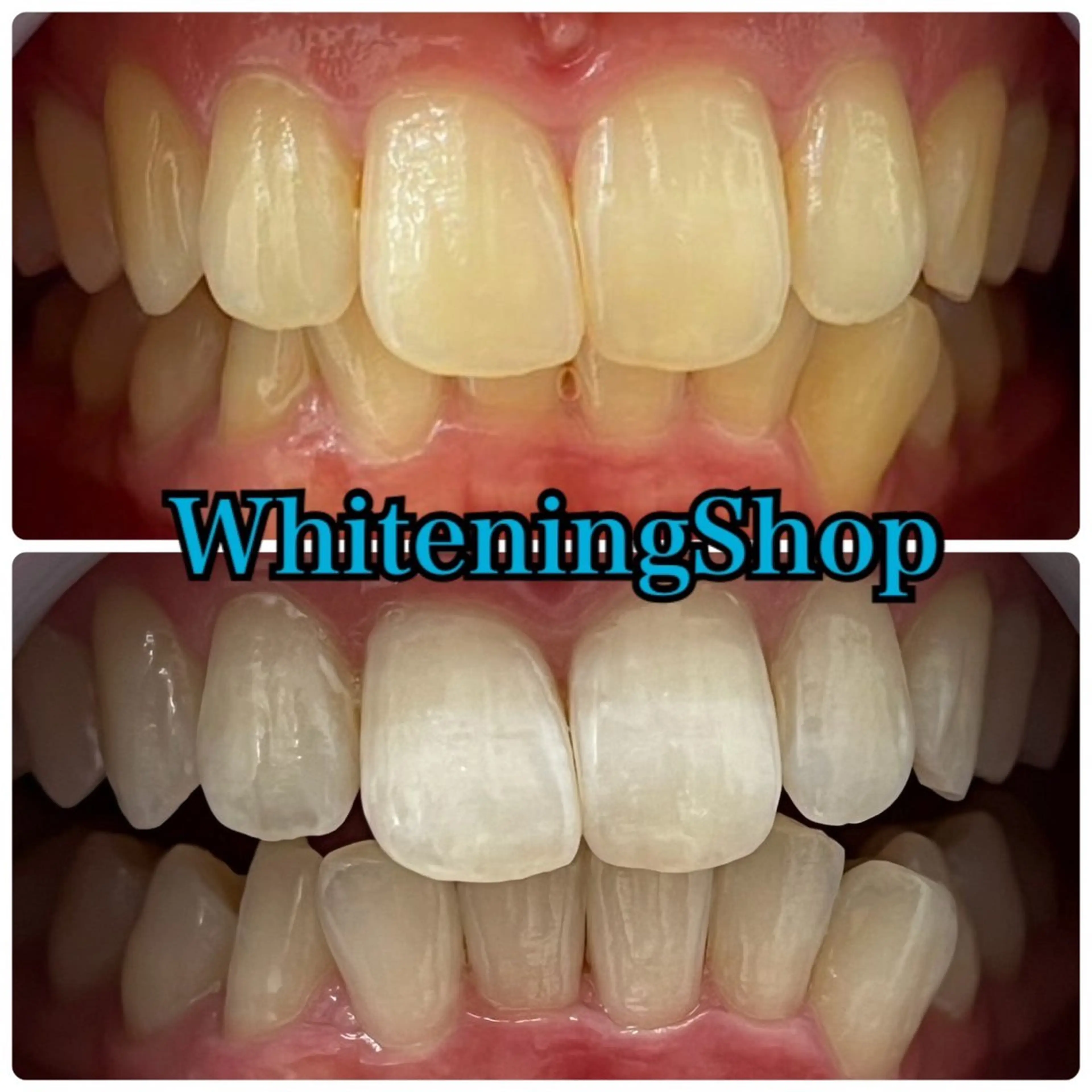 エステ リラク ホワイトニング ショップ吉祥寺店のエステ・リラクイメージ