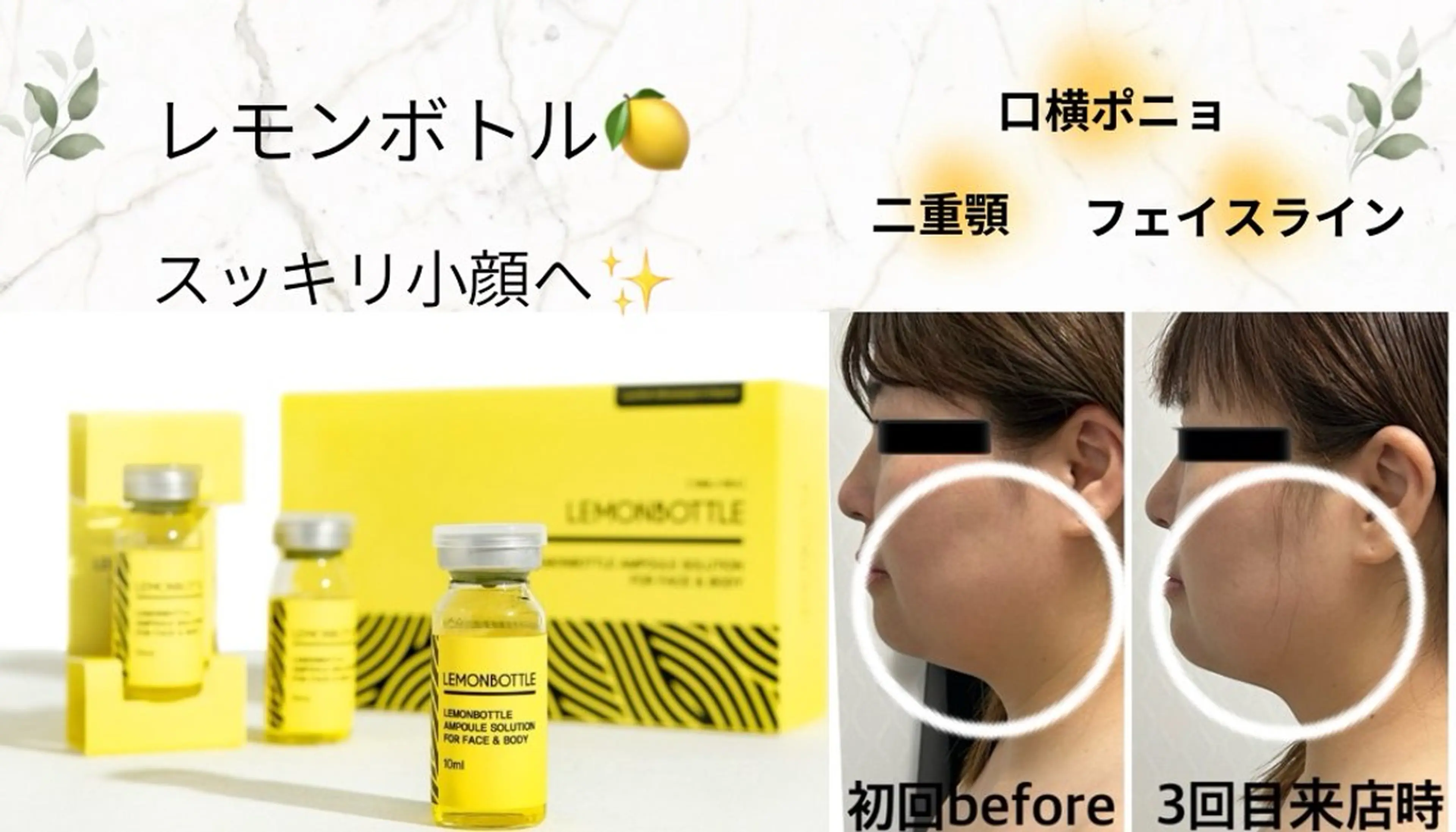 韓国発レモンボト🍋2cc導入コース 小顔ケア/むくみ/二重あご対策の写真