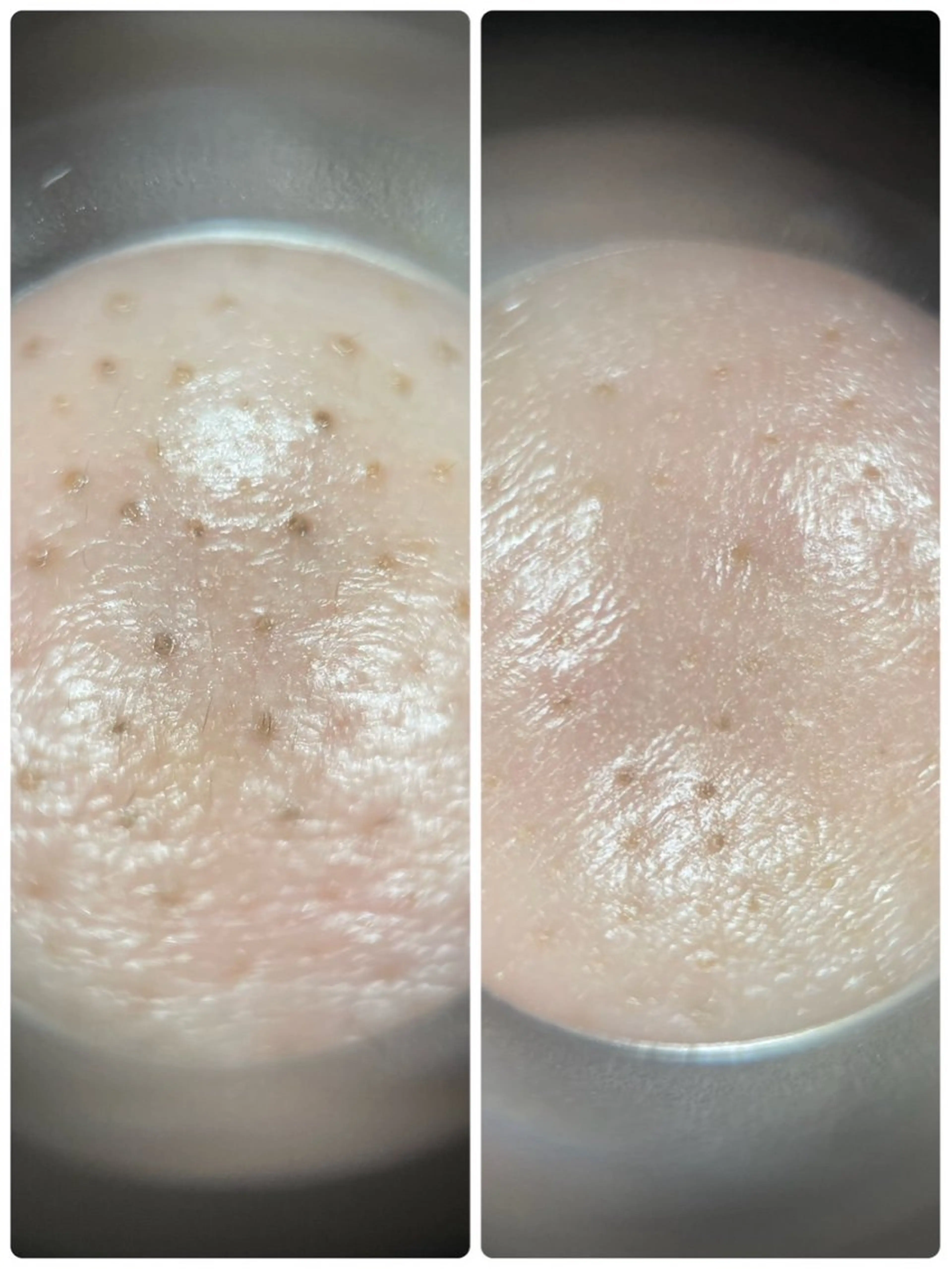 メナード宮の沢店 コトコのエステ・リラクイメージ