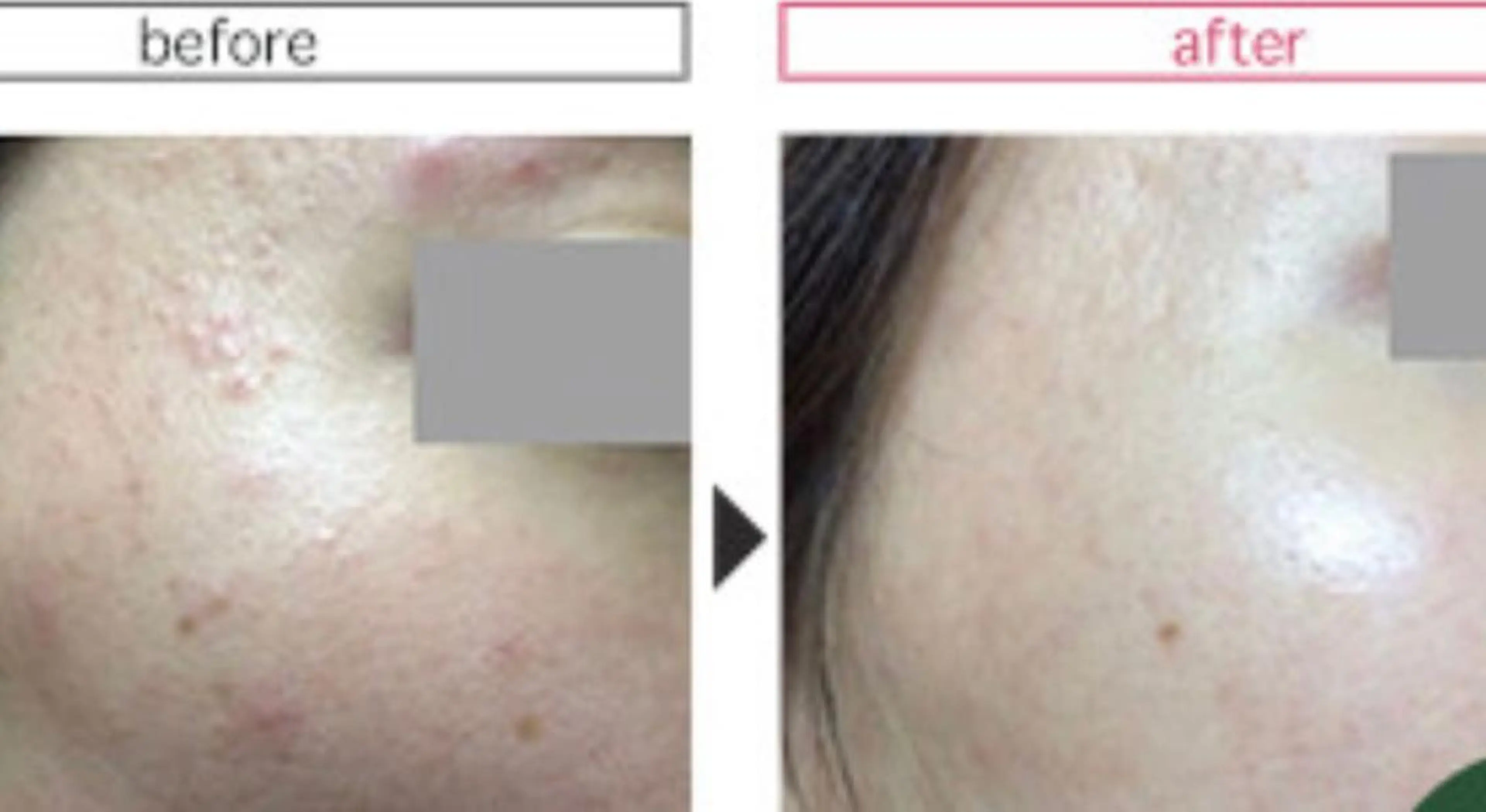 矯正痩身サロン 南国あまみんちゅのエステ・リラクイメージ