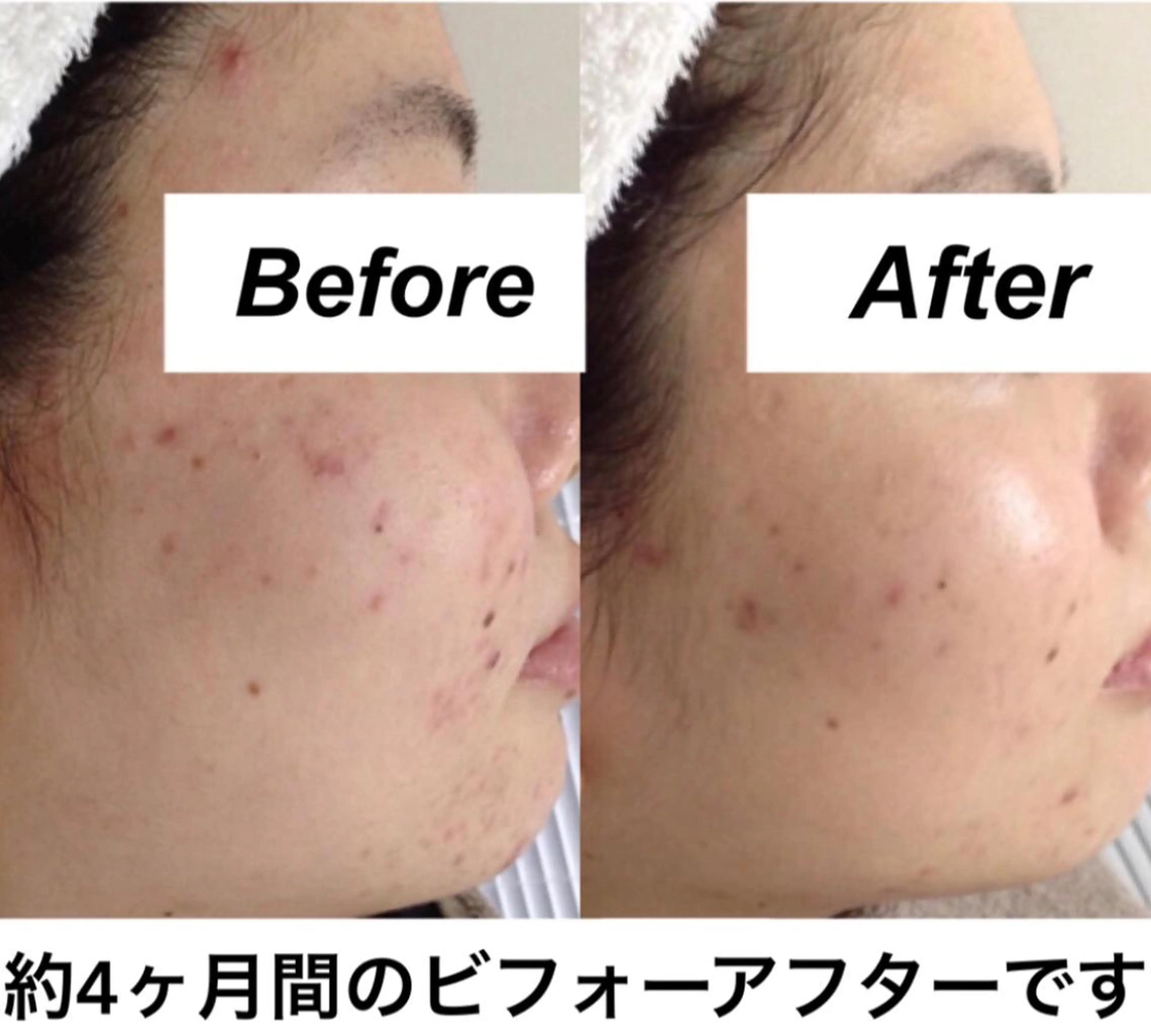 エステ リラク 都度払い肌質改善 &脱毛Blancheのエステ・リラクイメージ