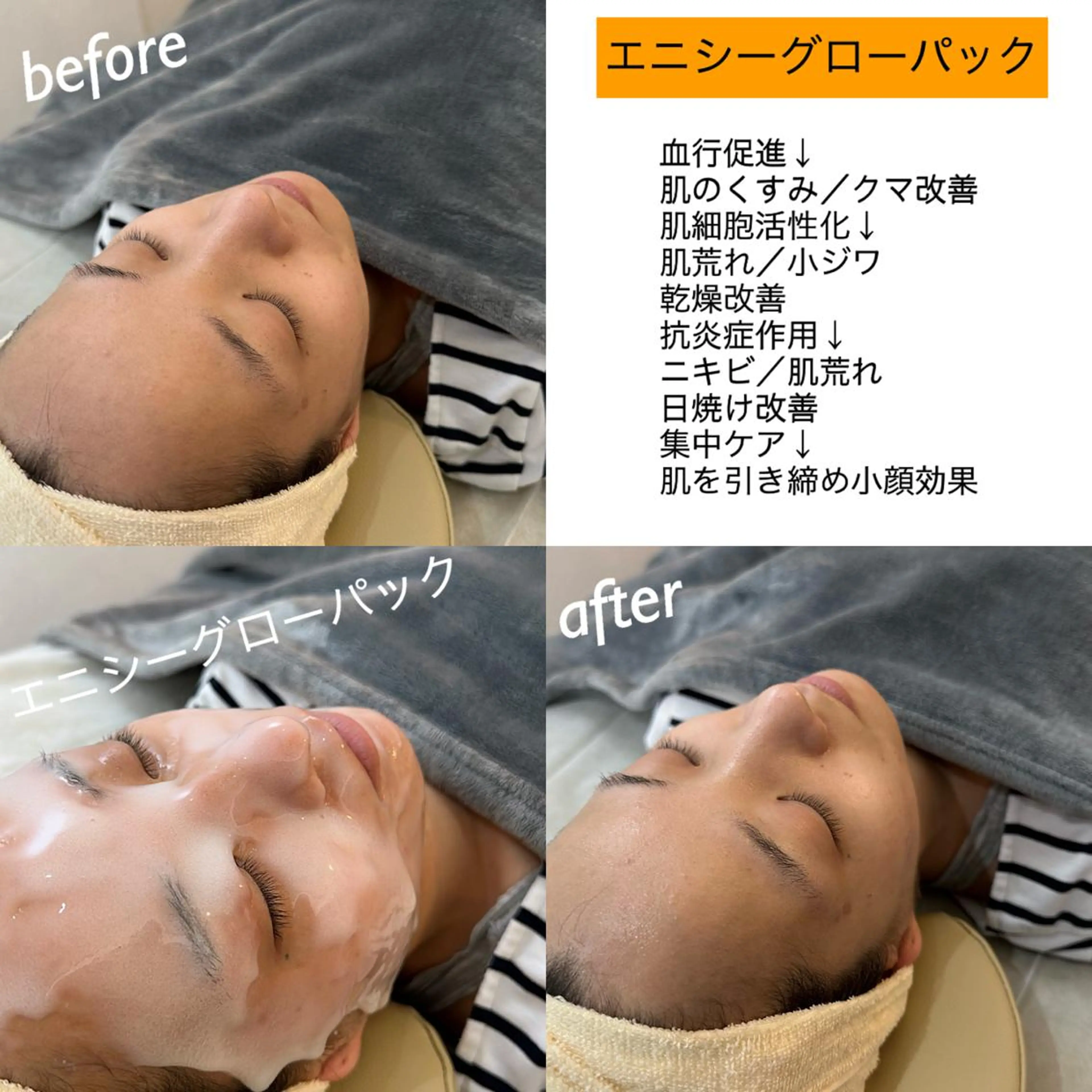 うなじ脱毛/美肌脱毛 LABELのエステ・リラクイメージ