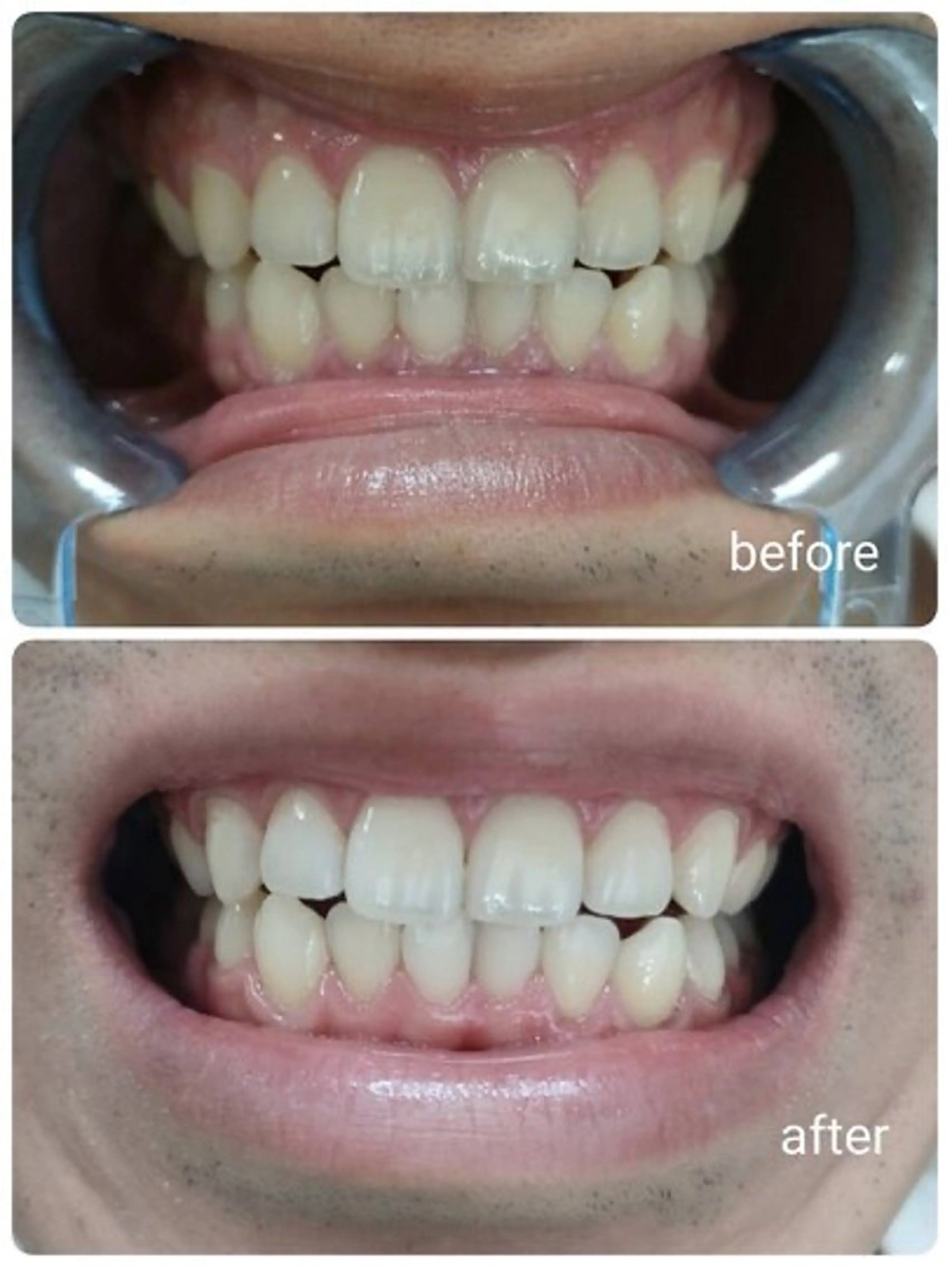 エクシア ホワイトニング西条店のその他イメージ