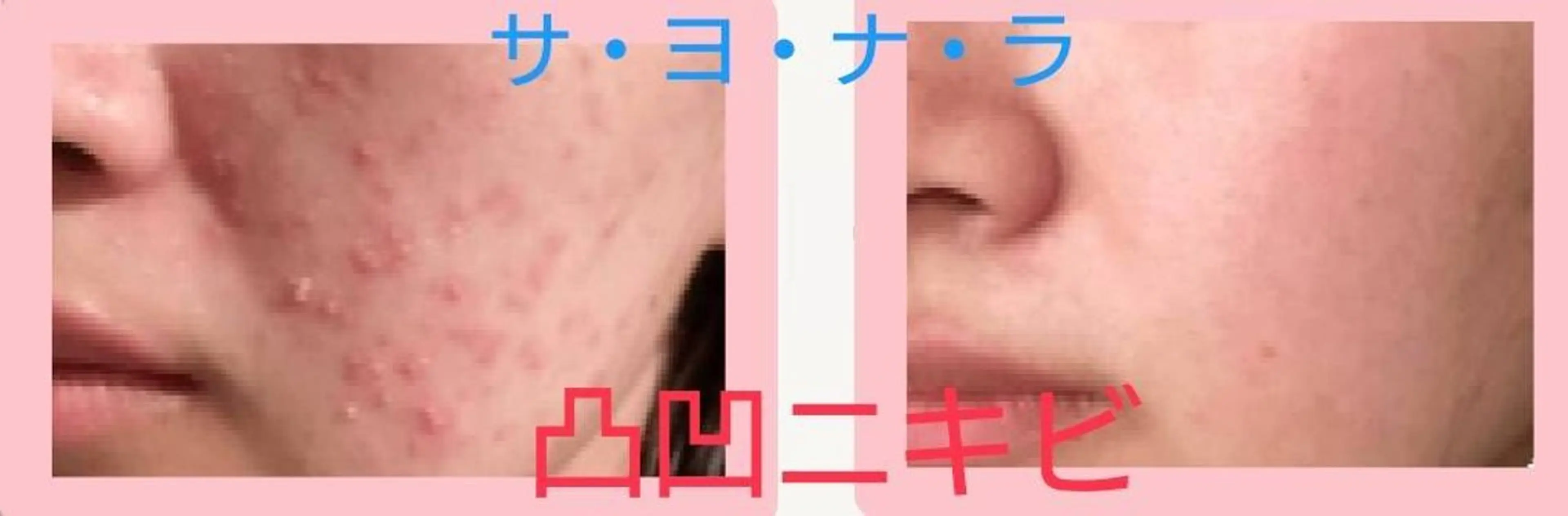 エステ ハーブピーリング 専門店Kikkaのエステ・リラクイメージ