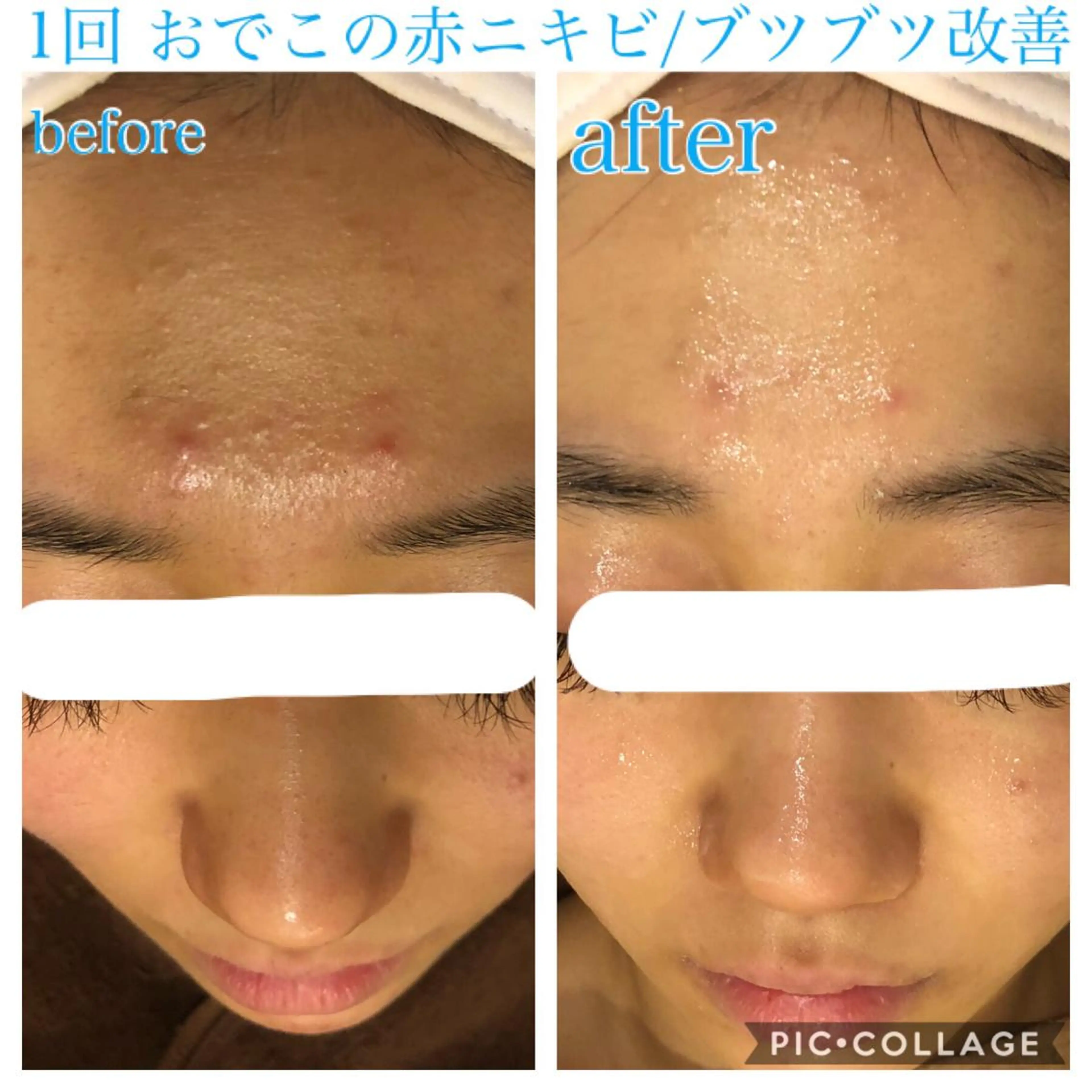 ショート カラー パーマ ヘアアレンジ キッズ ネイル マツエク・マツパ エステ リラク EnsorClair 代表 野口真央のエステ・リラクイメージ
