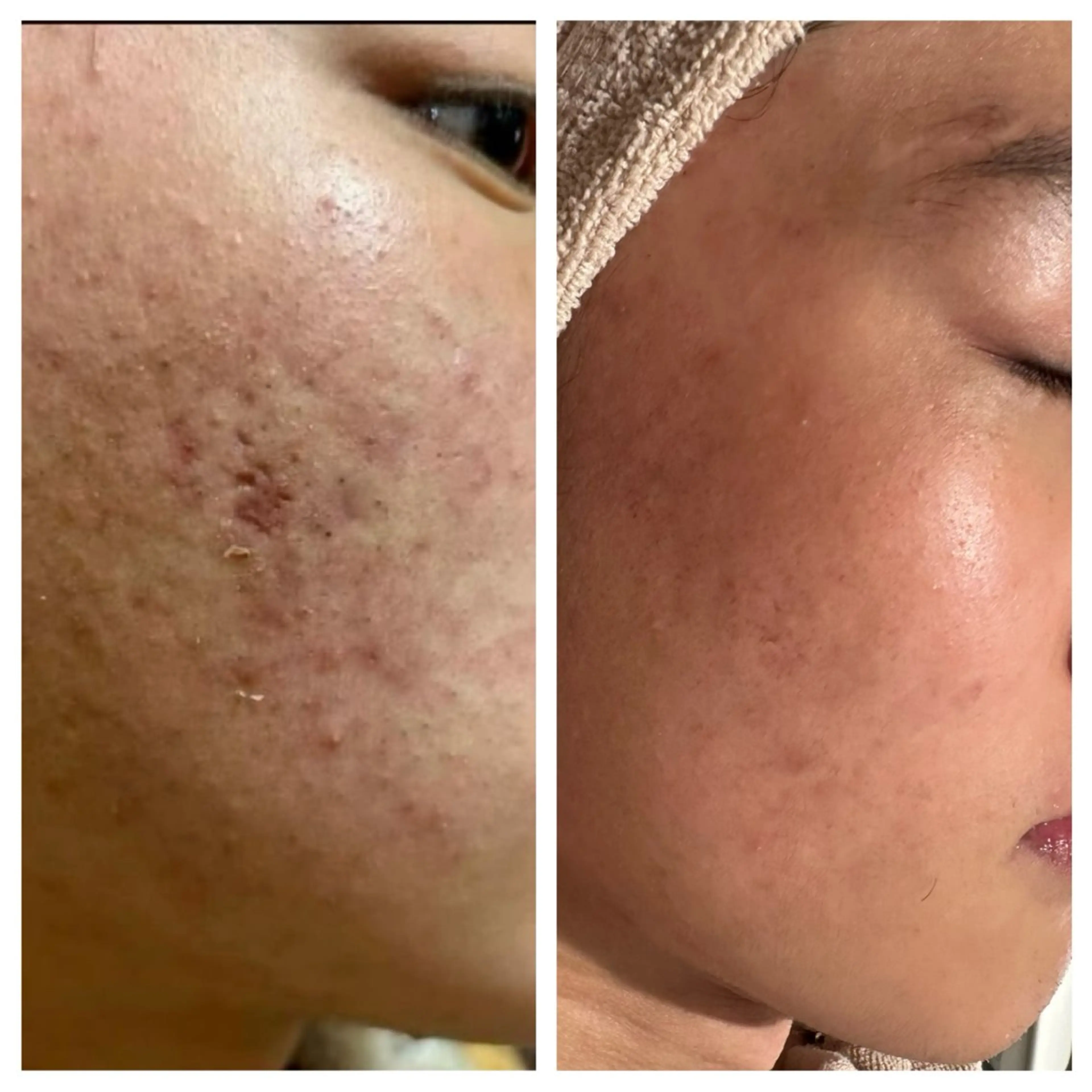 エステ 尾上 沙織のエステ・リラクイメージ