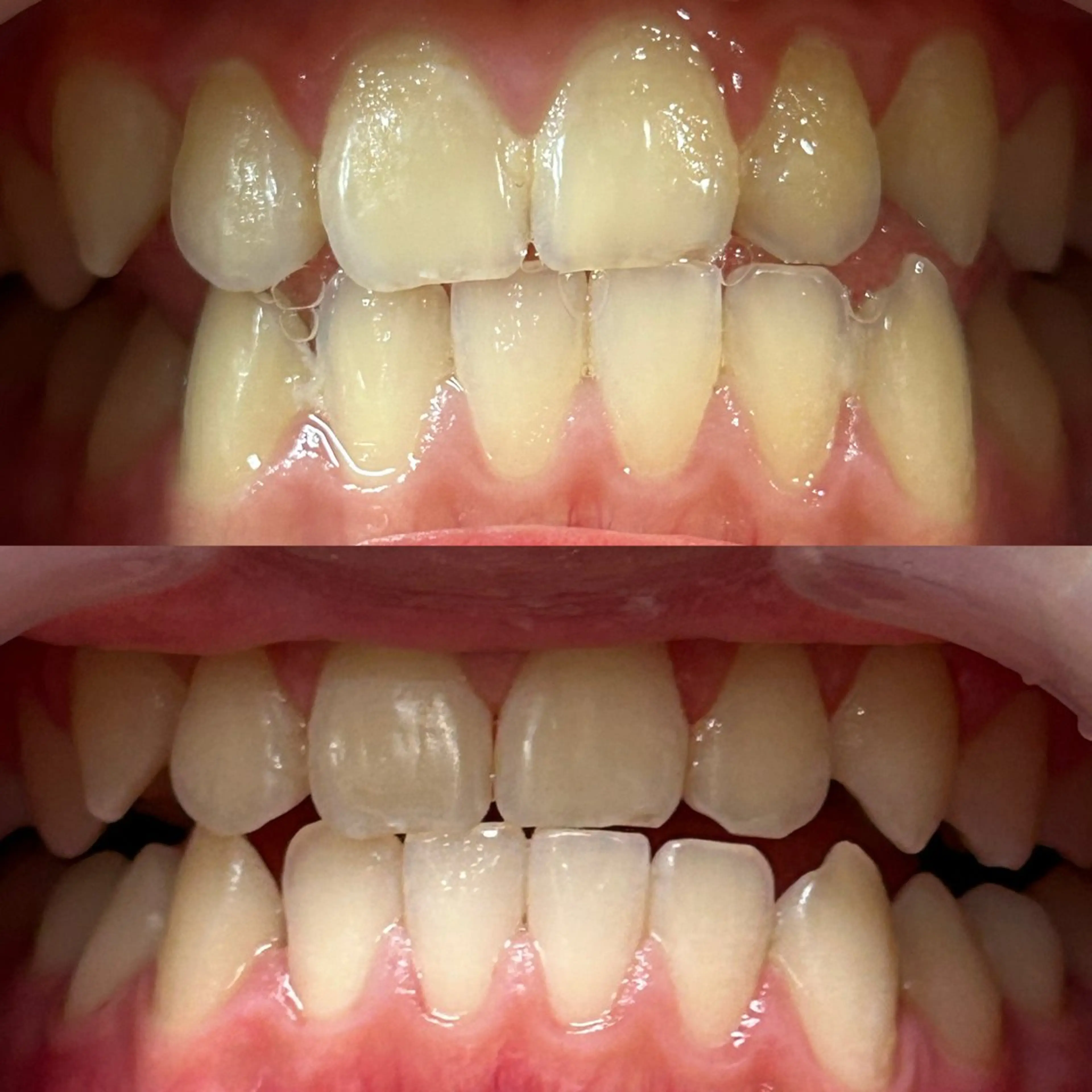 セルフホワイトニング 〜幸Sachi〜のその他イメージ