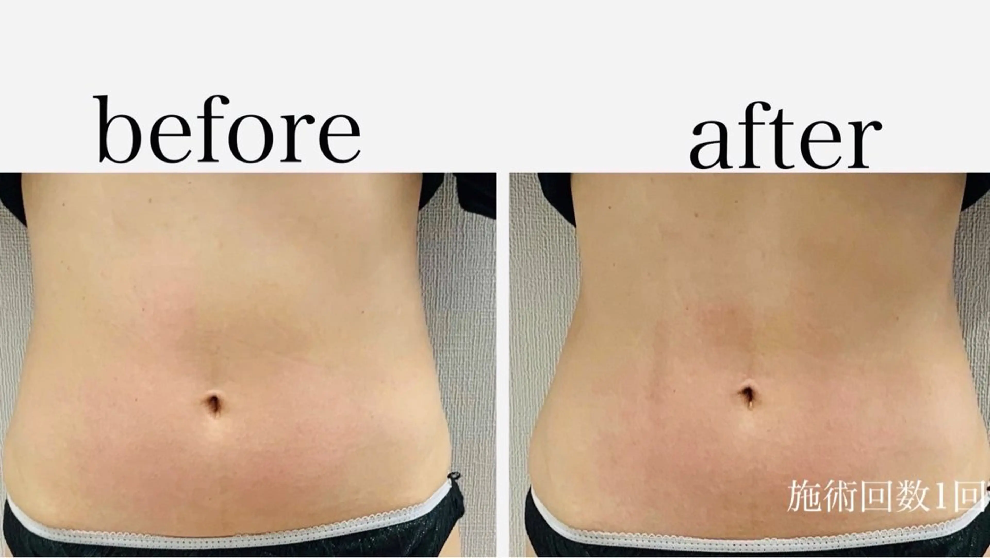 エステ Genesis Plus大津京店のネイルデザイン