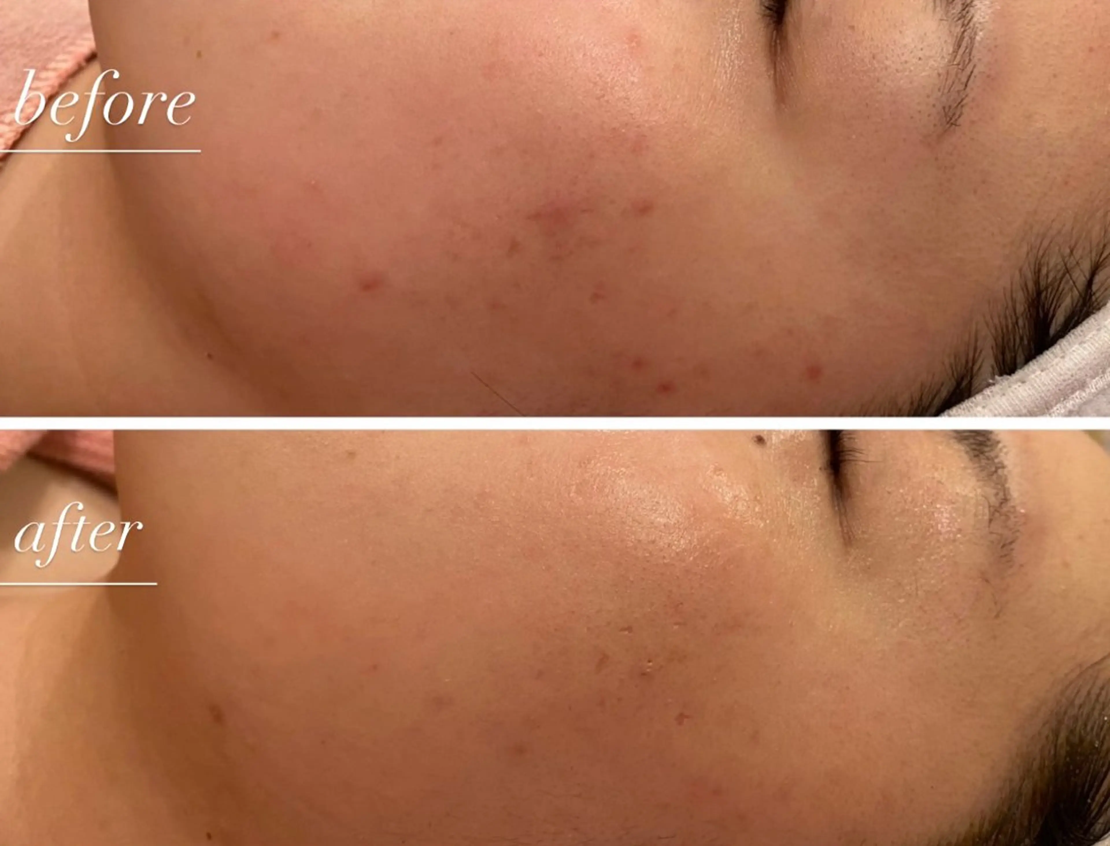 lovin manaのその他イメージ