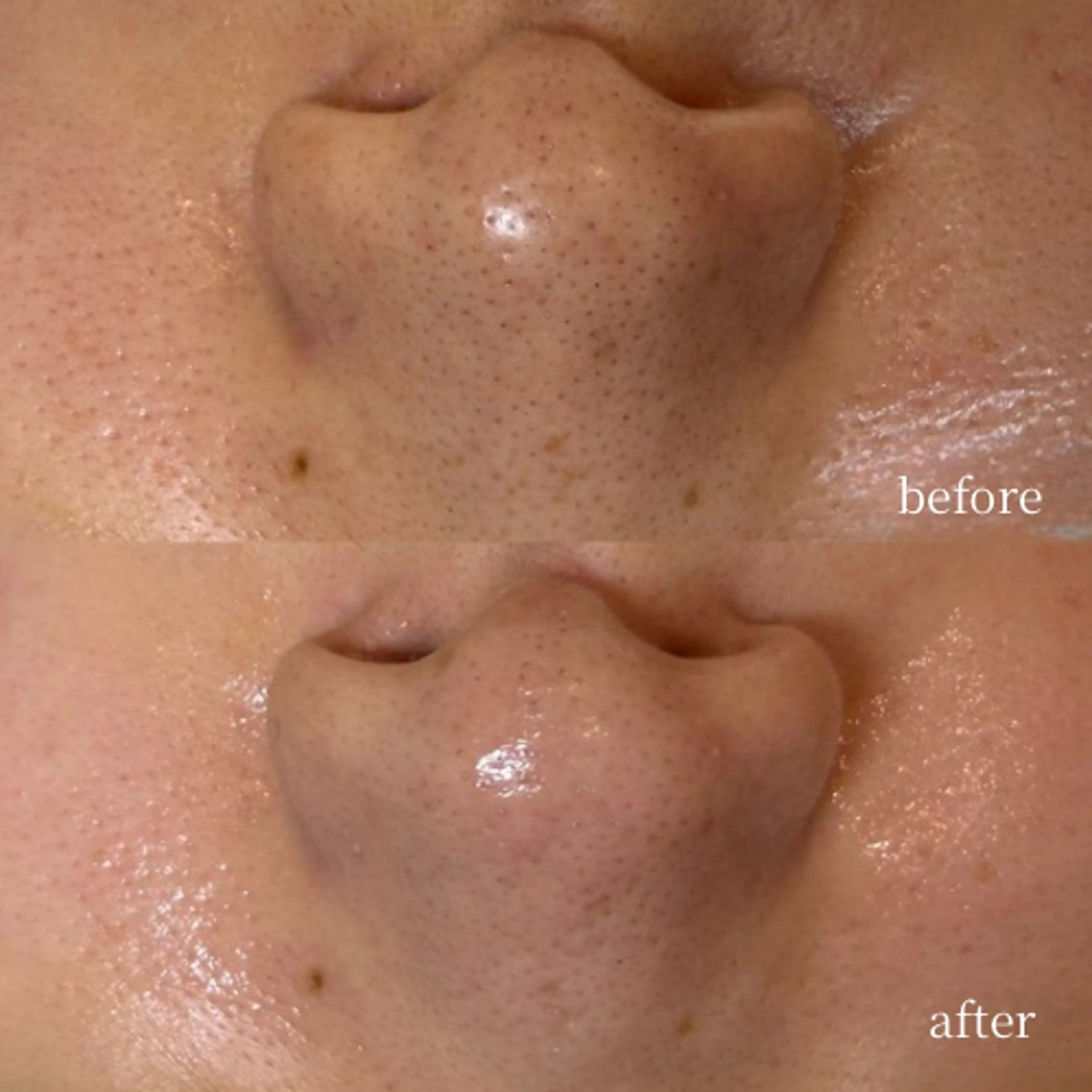 エステ 韓国肌管理・肌質改善 EARNEST心斎橋のエステ・リラクイメージ