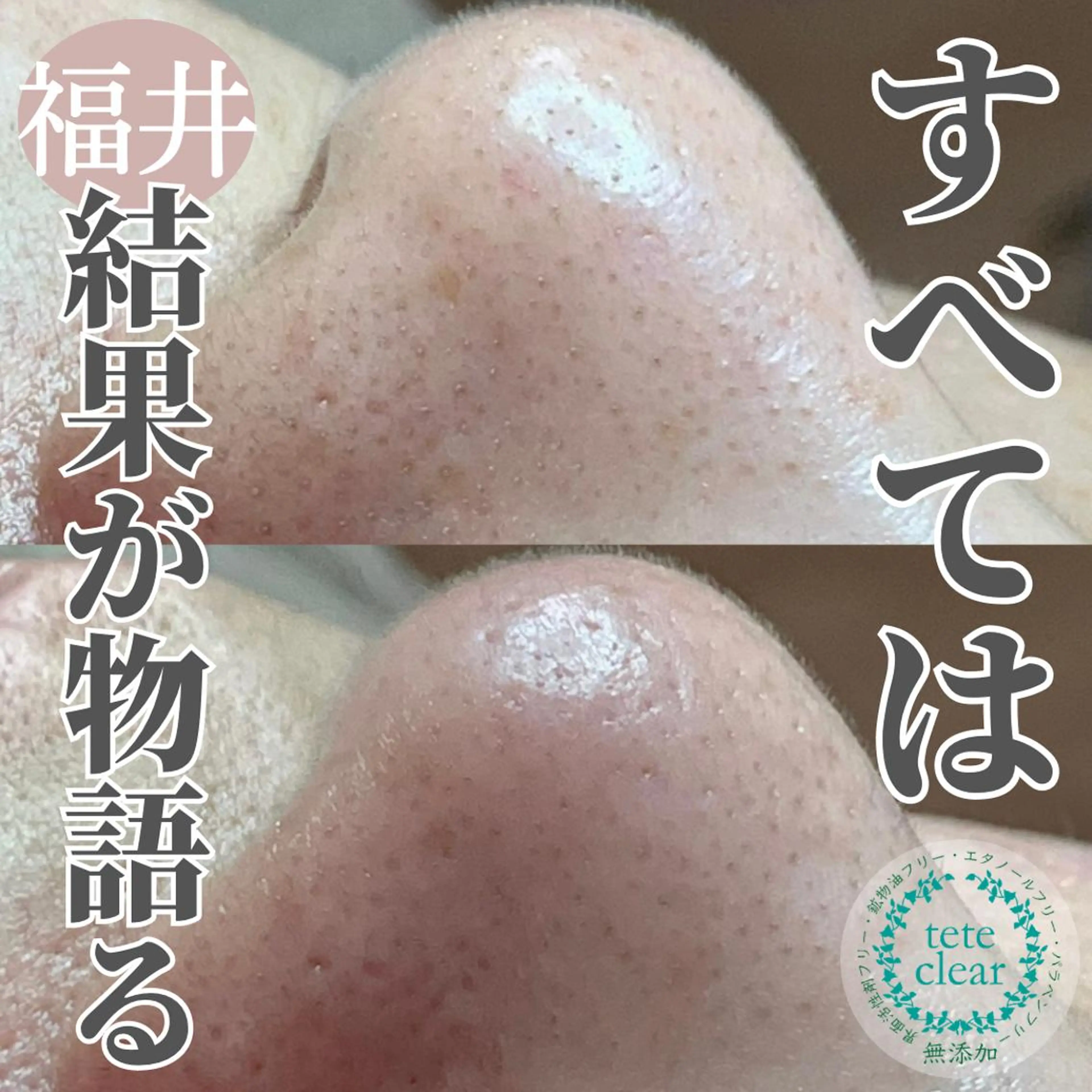 毛穴肌質ケアサロン Yourmeユアミーのエステ・リラクイメージ