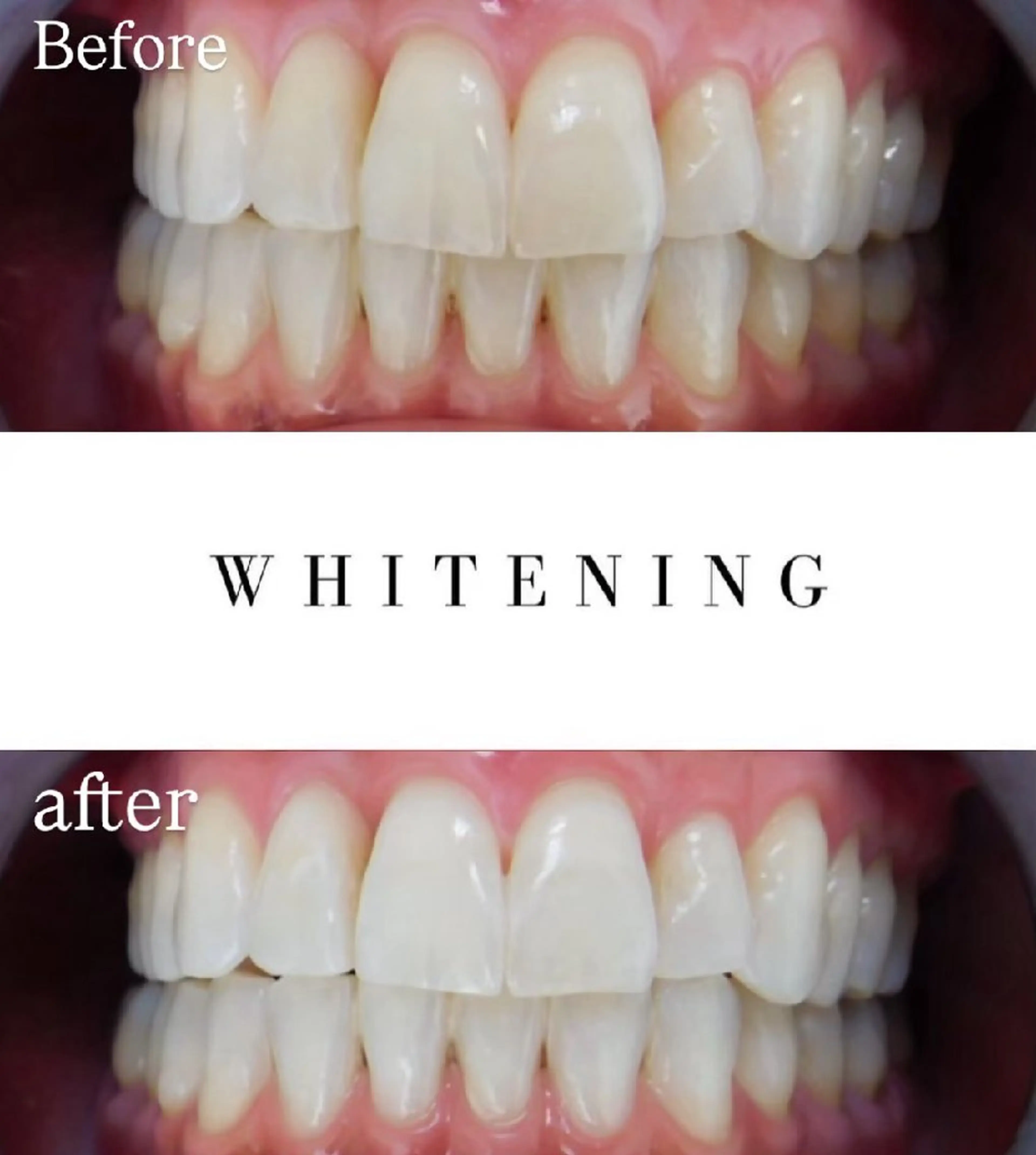 その他 Luv the TERRACEの眉毛・アイブロウイメージ