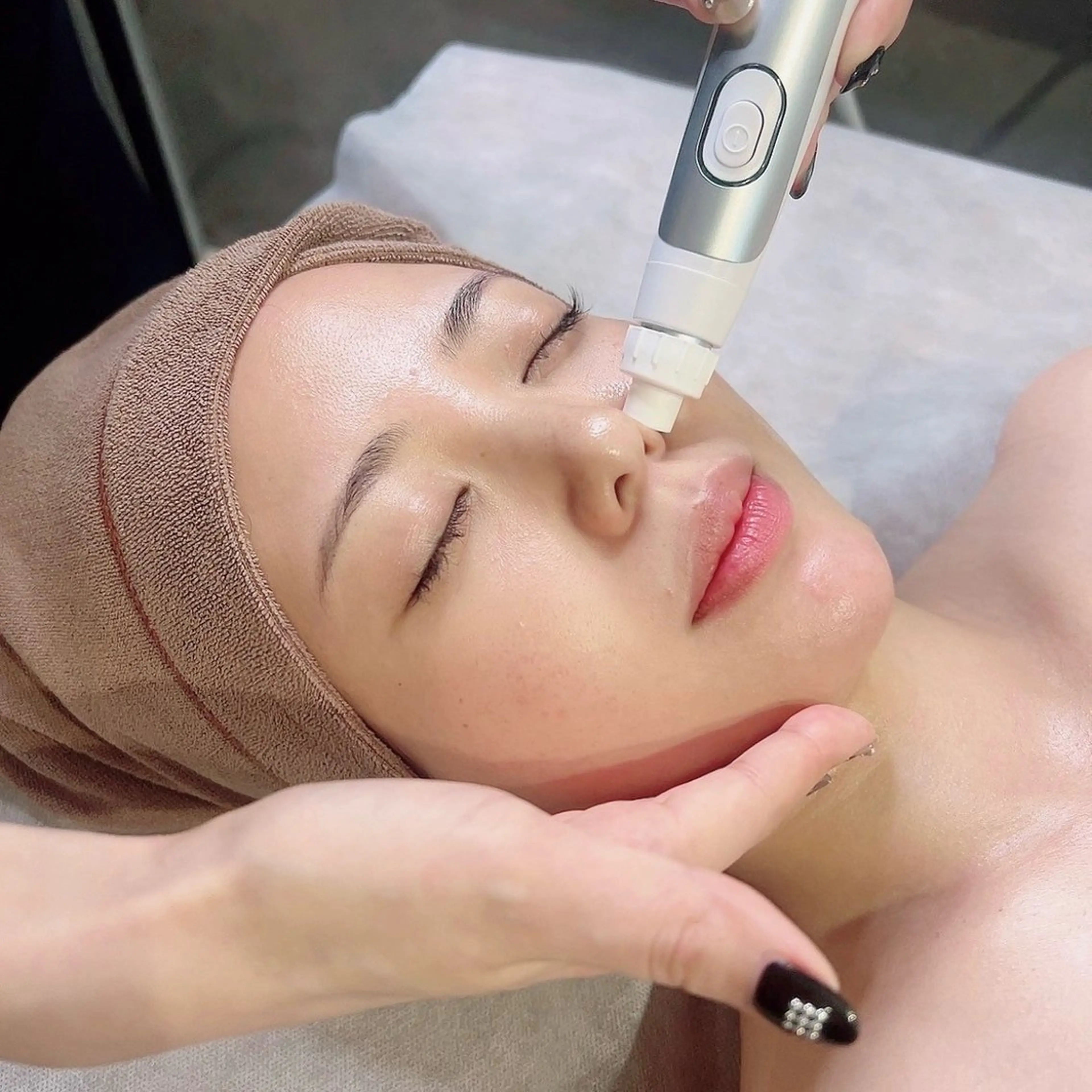 【男女⭕️】お顔ワックス脱毛✖️毛穴洗浄🫧¥9,400 産毛や角質をオフし剥きたてのゆで卵のようなツヤ肌へ✨の写真