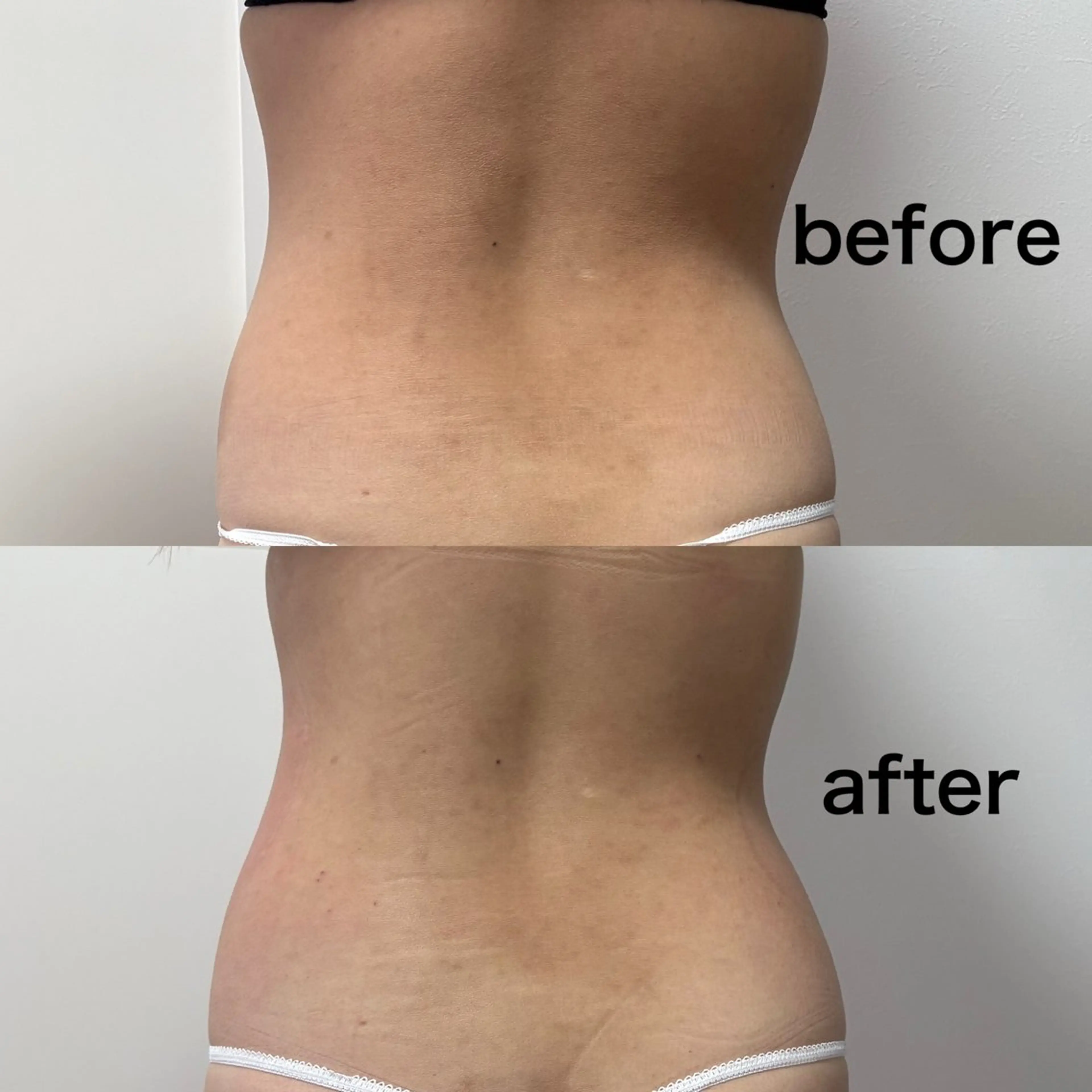 石巻 冷却痩身 Miiju. 鈴木のエステ・リラクイメージ