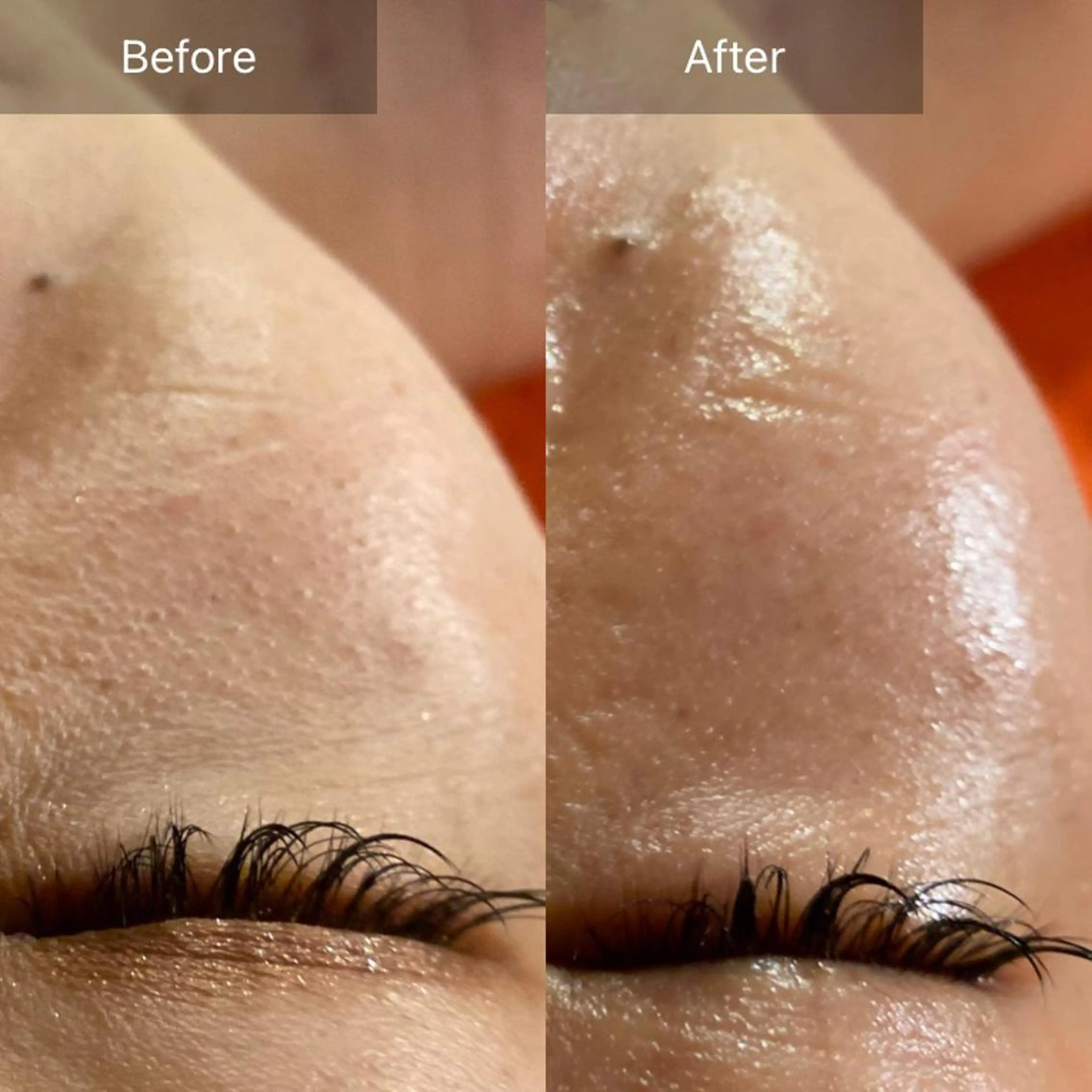 毛穴から始める肌メン テマンダリンオレンジのエステ・リラクイメージ