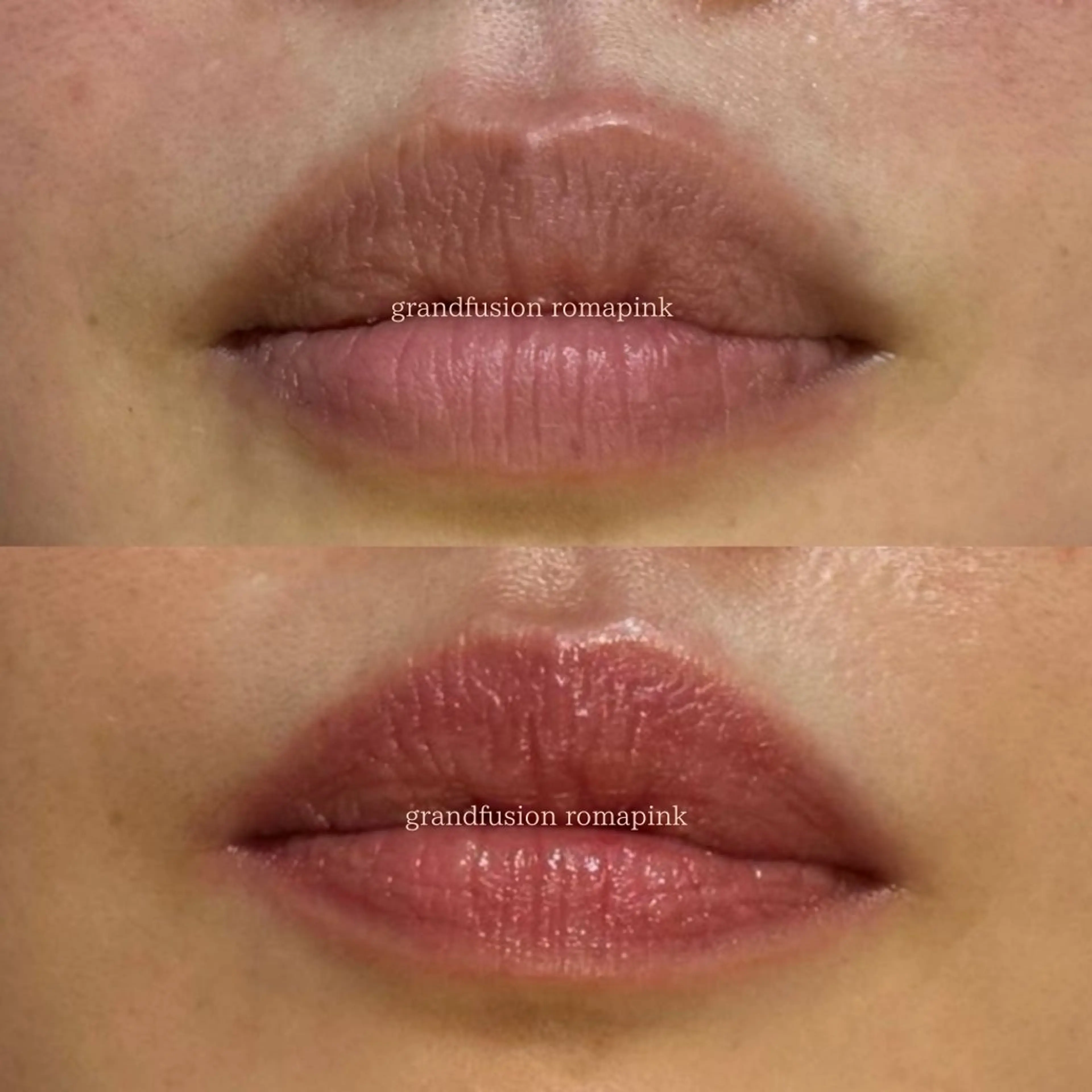 エステ Richeri 代官山のエステ・リラクイメージ