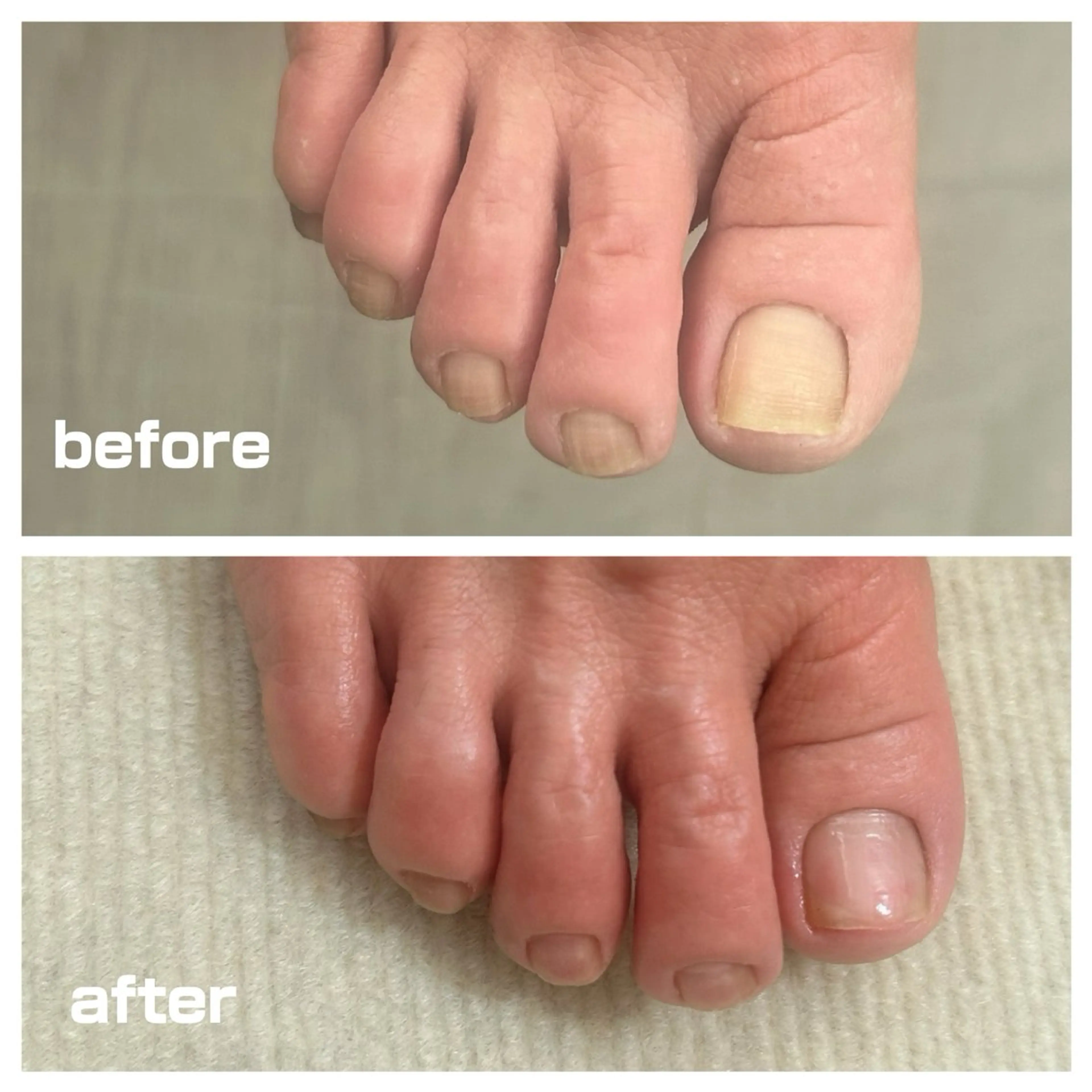 その他 フットケアサロン Kotoriのその他イメージ