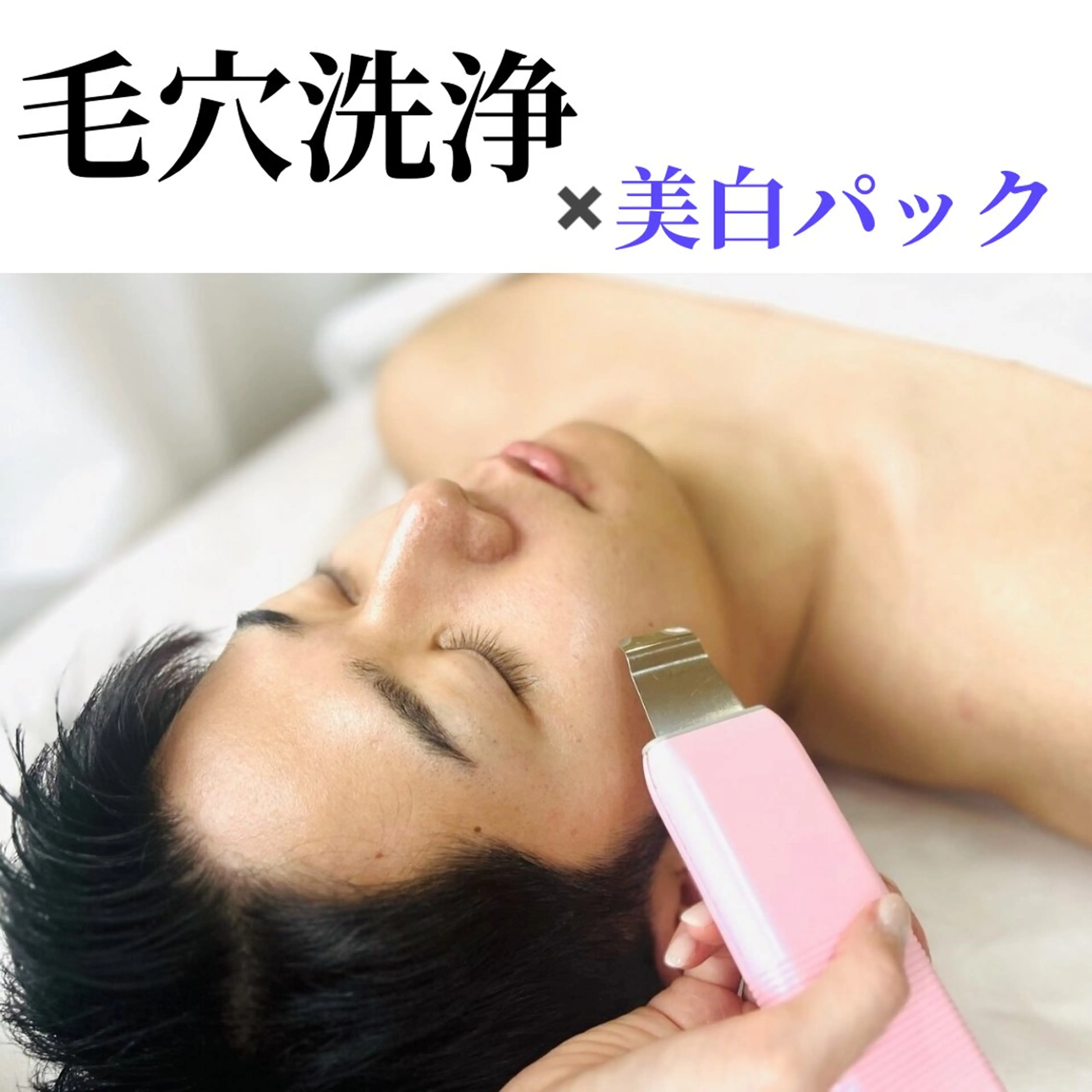【 毛穴洗浄×美白パック 】お手軽に毛穴の大掃除+美白ケアを🫧エステデビューの方にもｵｽｽﾒ ◎ ¥3,980の写真