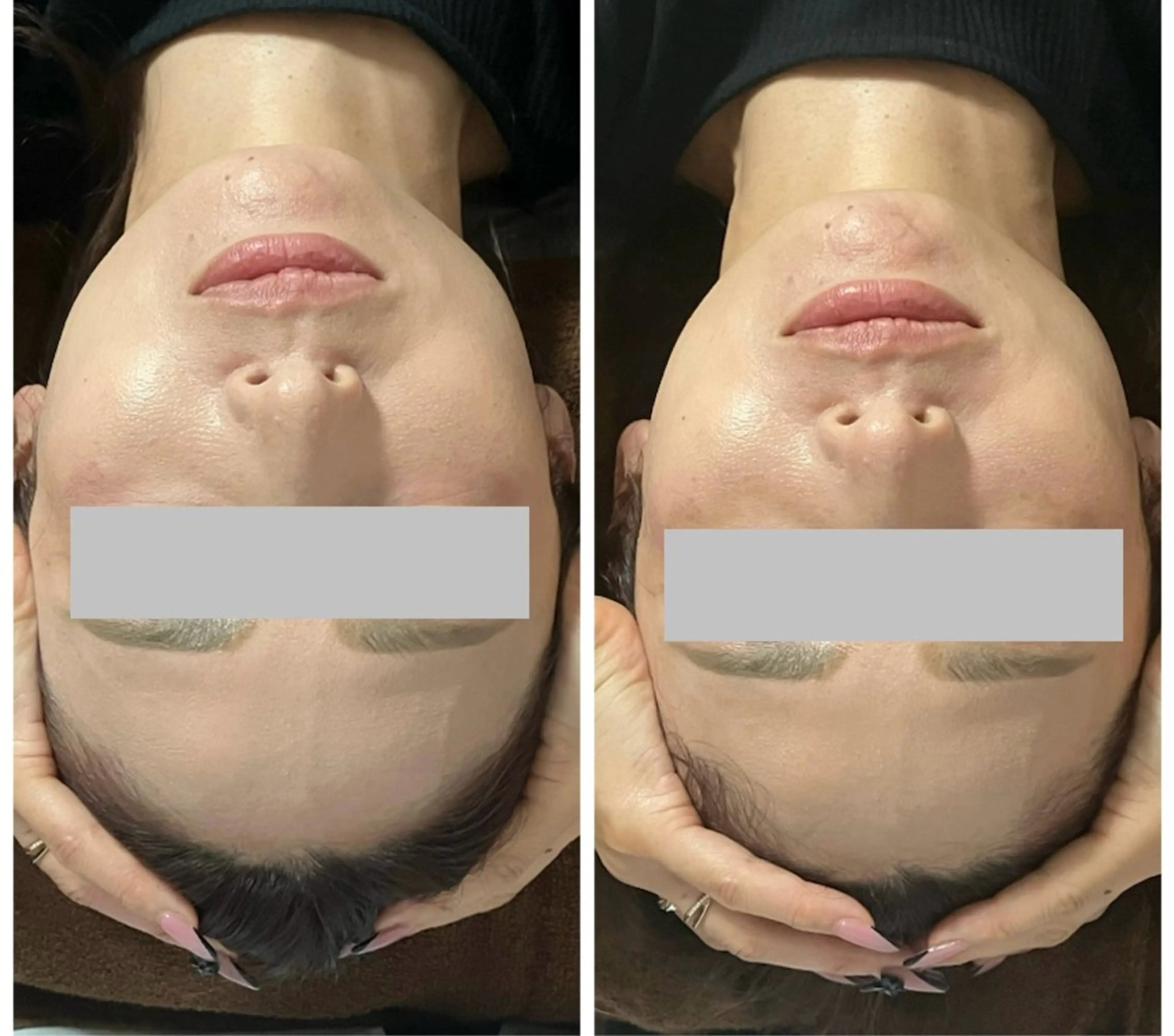 エステ 山口 夏生のエステ・リラクイメージ