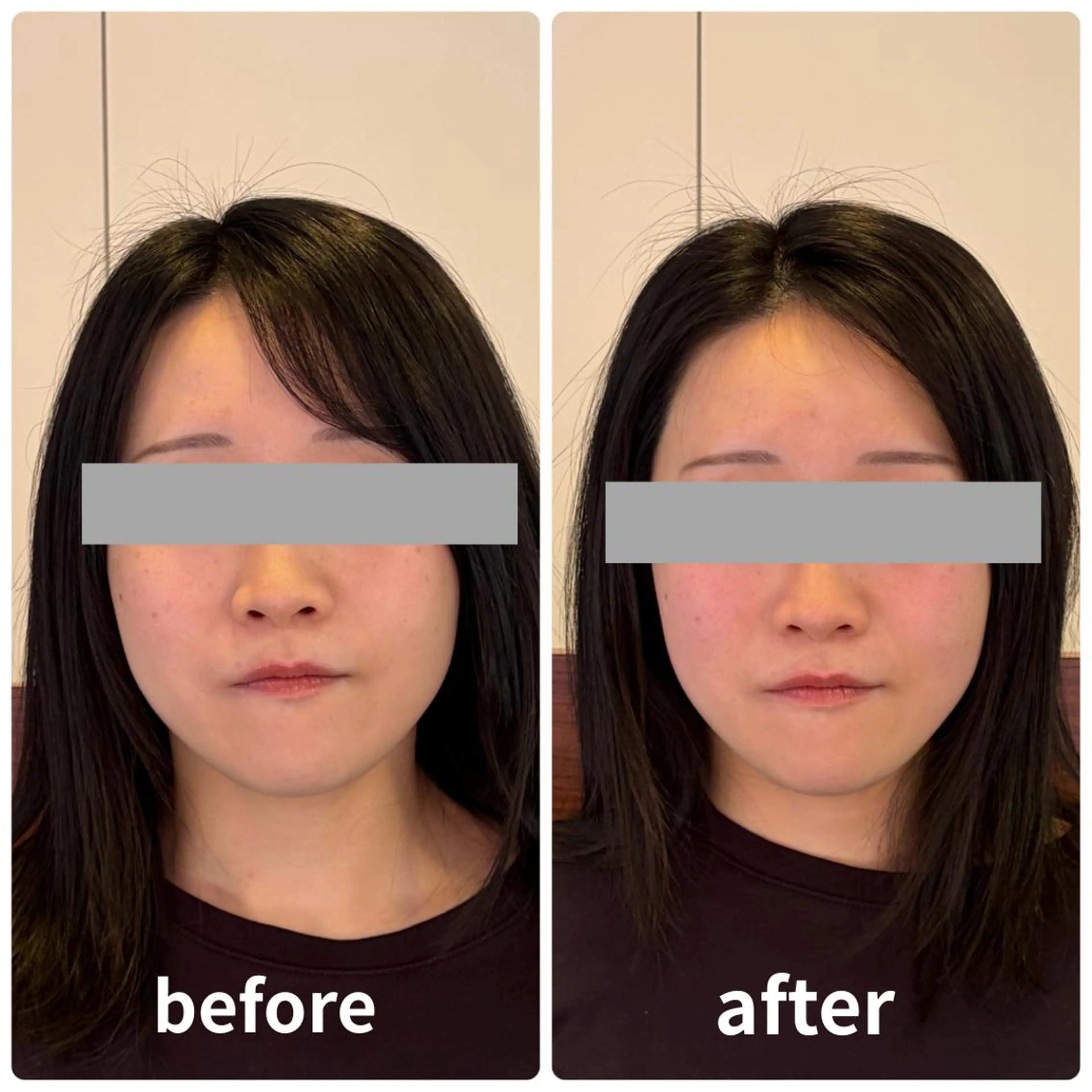 小顔矯正/整体師 丸山綾野のその他イメージ