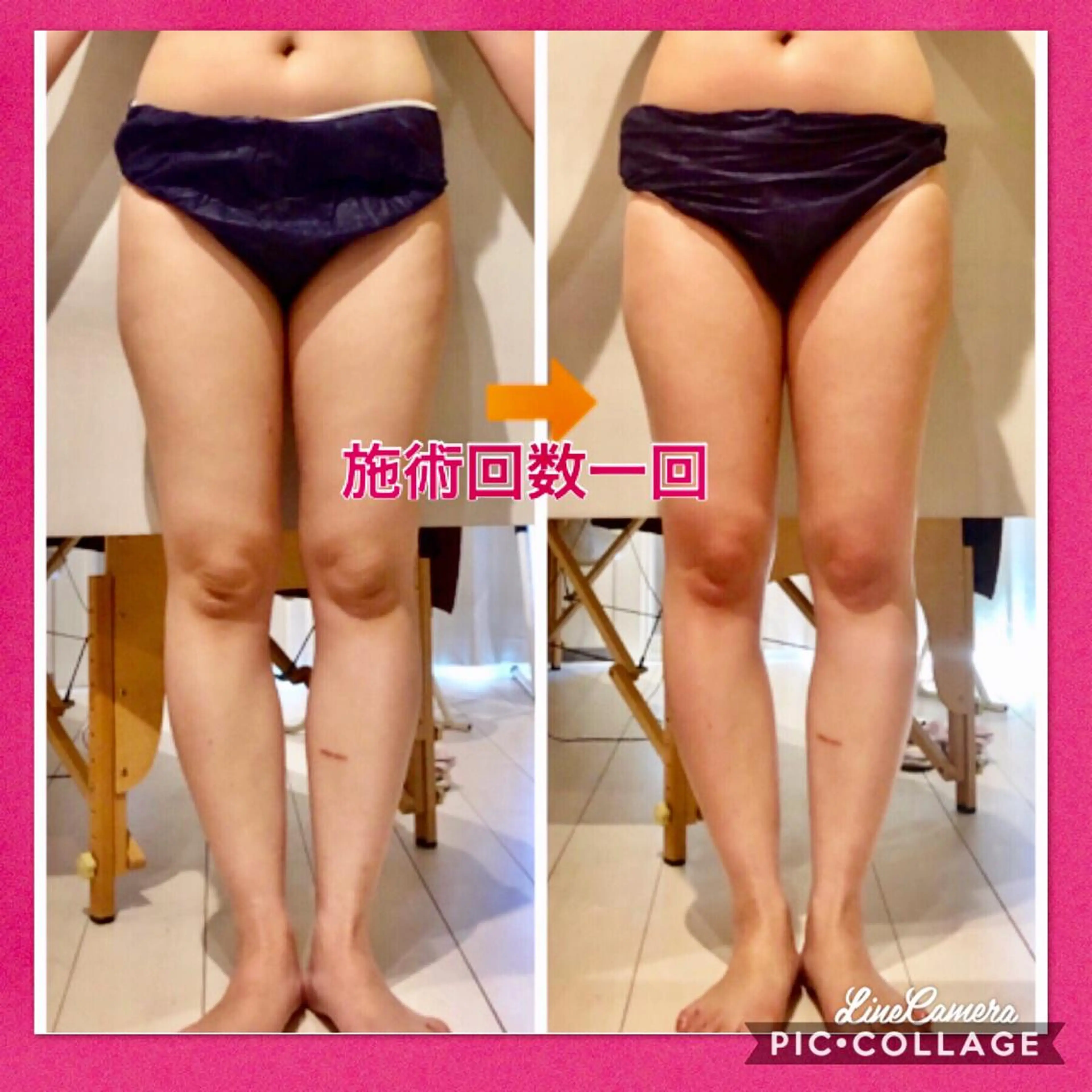 ショート カラー パーマ ヘアアレンジ メンズ キッズ ネイル マツエク・マツパ トリートメント ‍痩身＆ボディ 結果出し🌟丹野のエステ・リラクイメージ