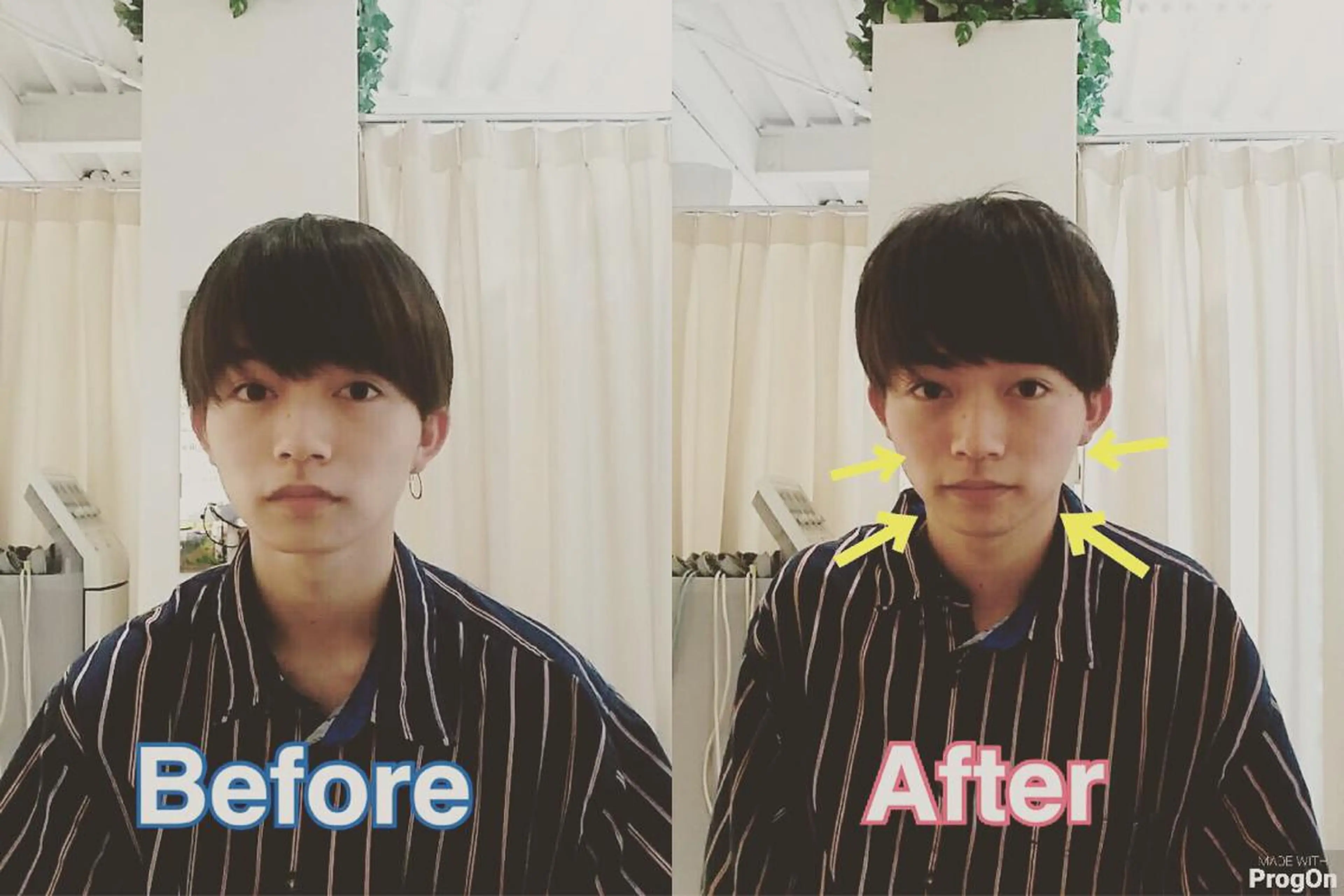 鍼灸整骨院Refine所属・鍼灸 Refineのその他イメージ