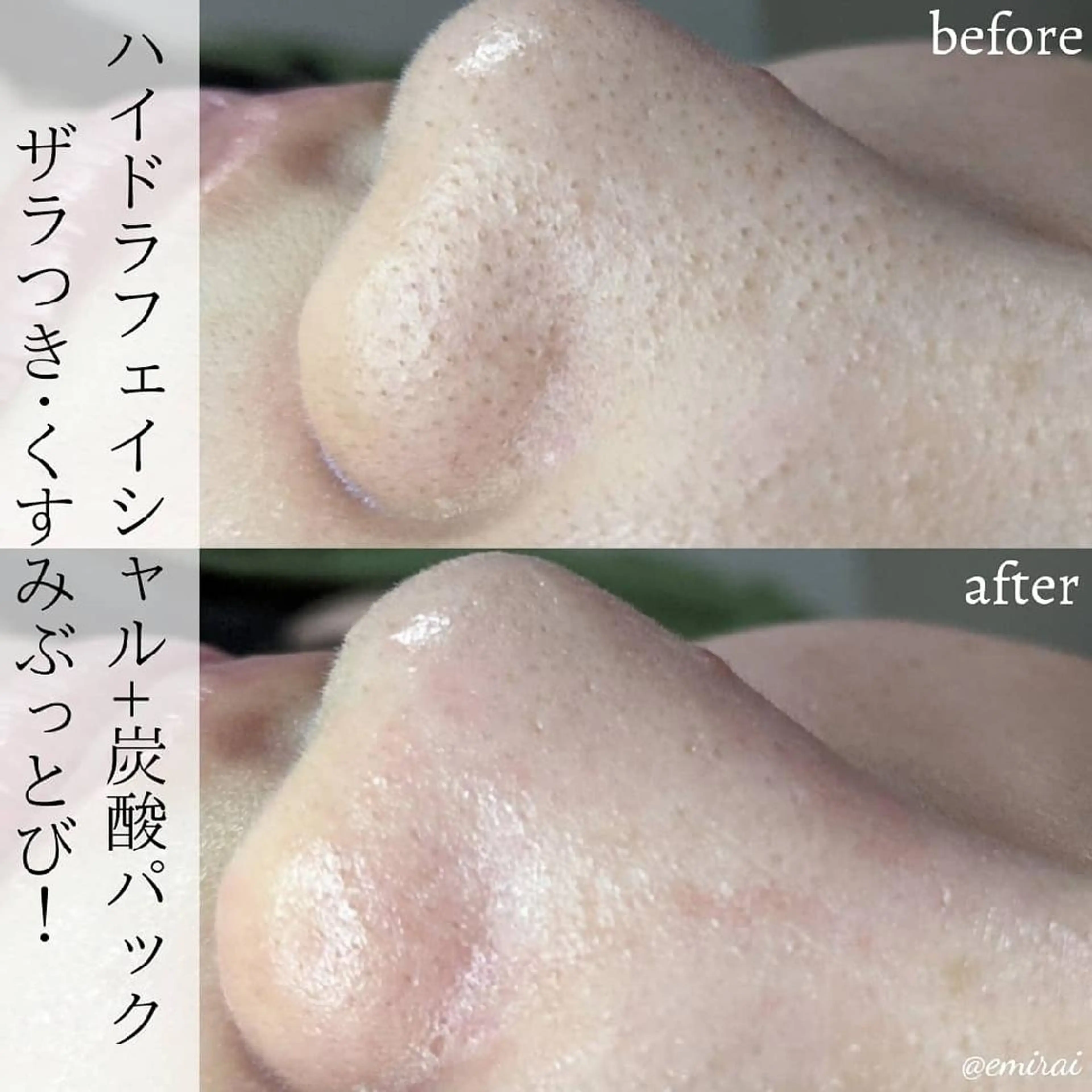 🌿emirai SEN🌿のエステ・リラクイメージ