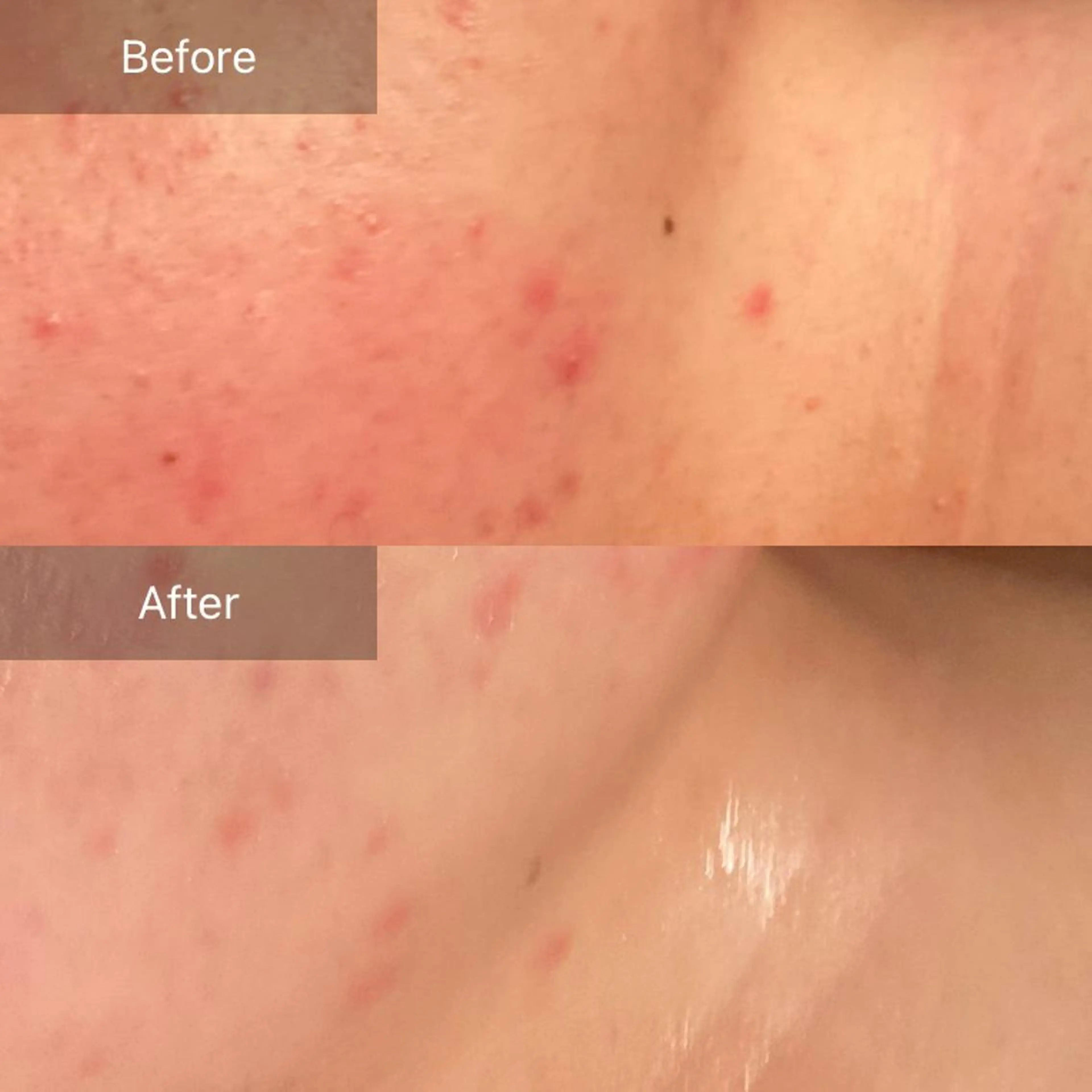 Mandarin Orange所属・毛穴から始める肌メン テマンダリンオレンジのエステ・リラクイメージ